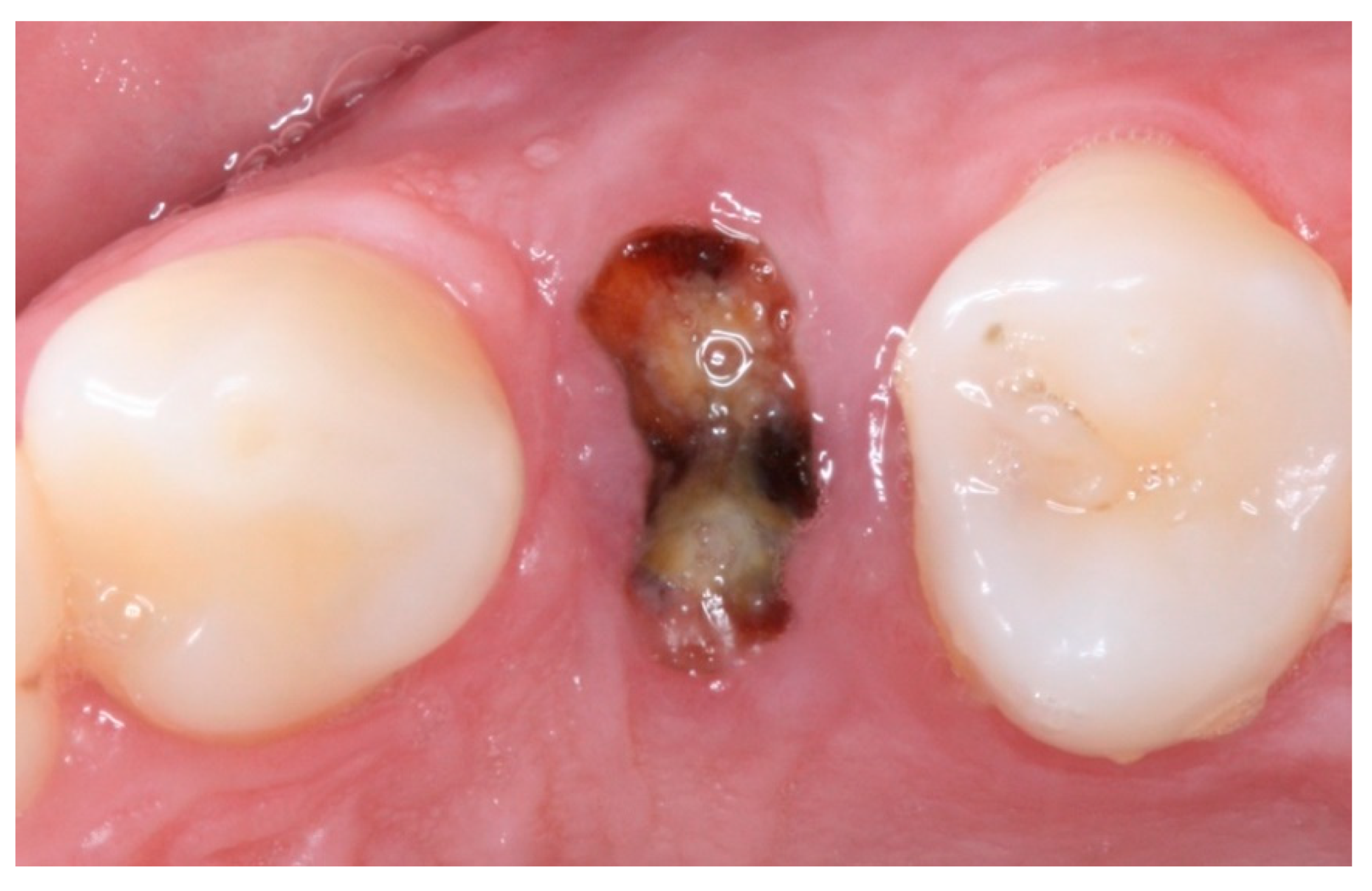 Materials 12 02902 g006