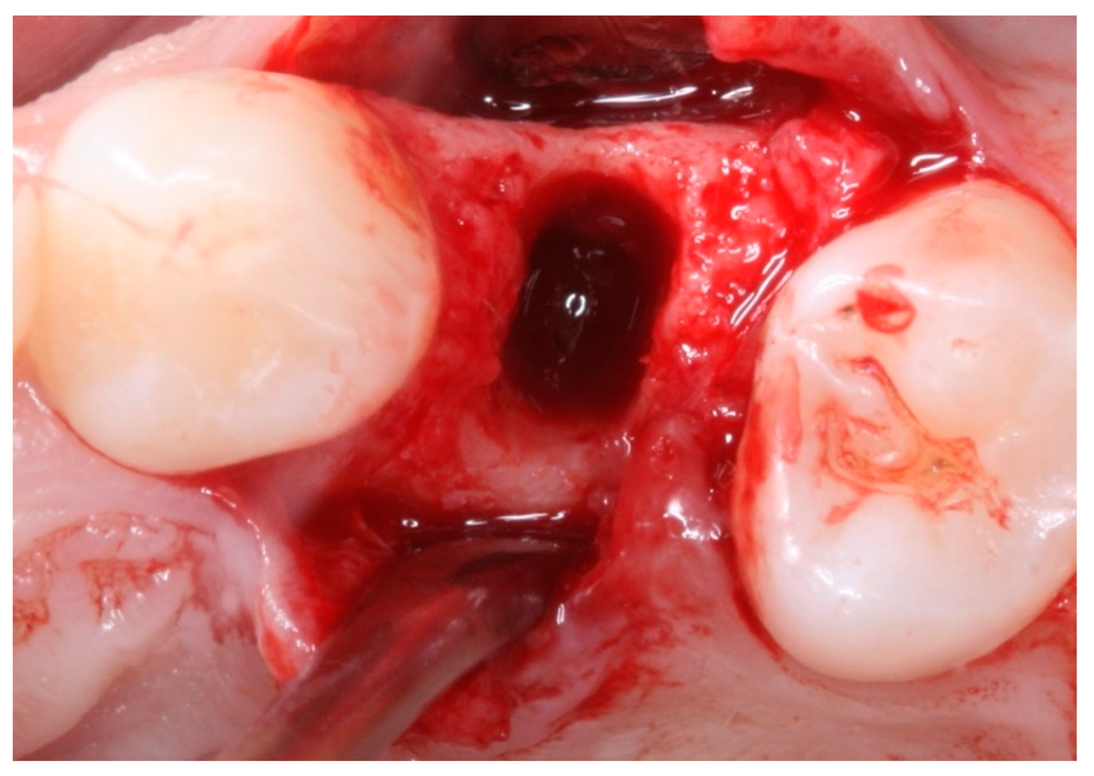 Materials 12 02902 g007