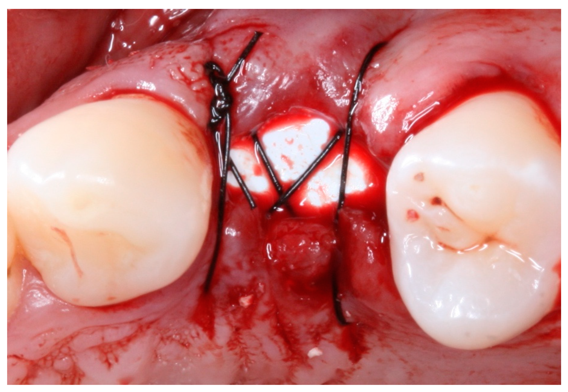 Materials 12 02902 g009