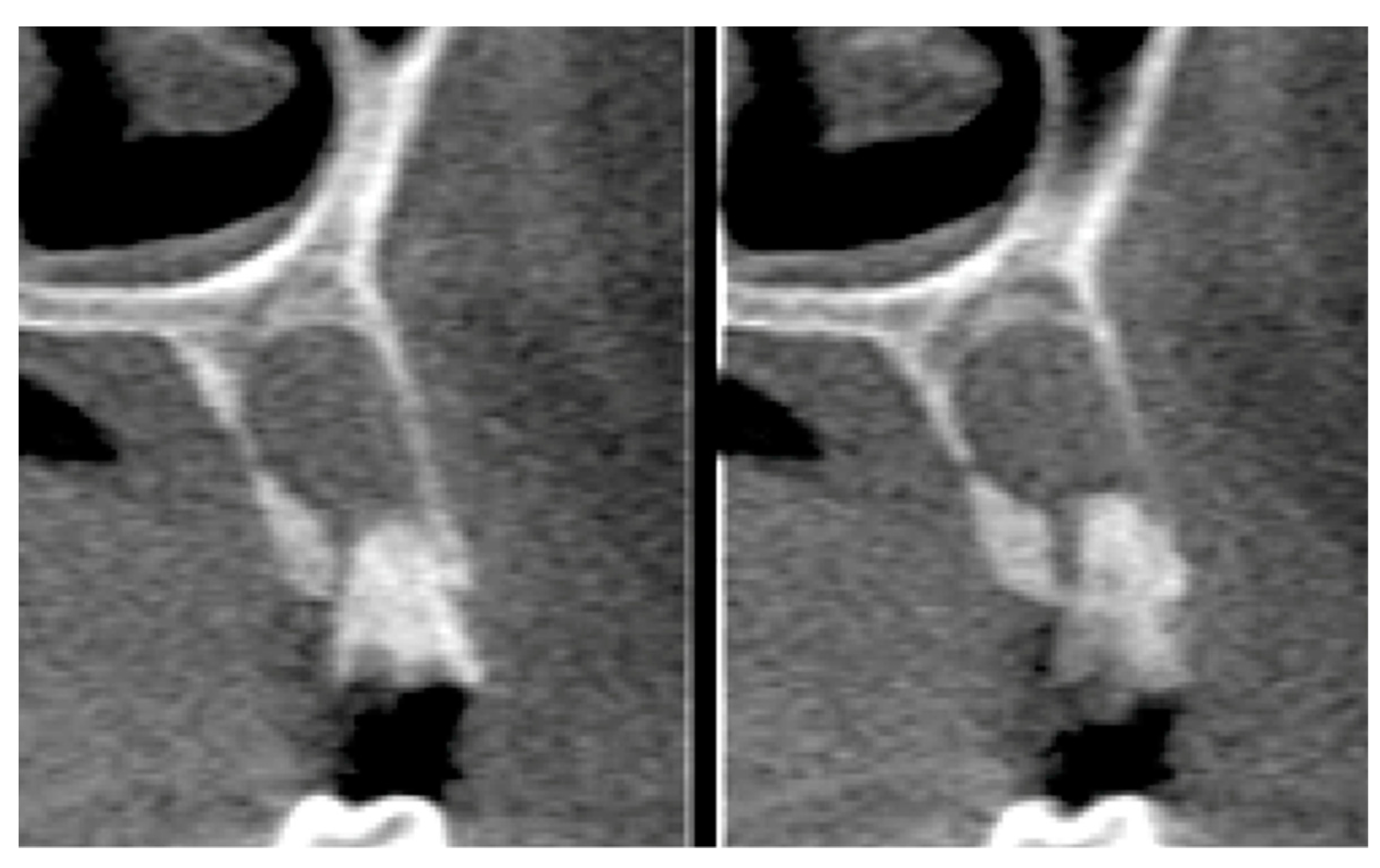 Materials 12 02902 g011