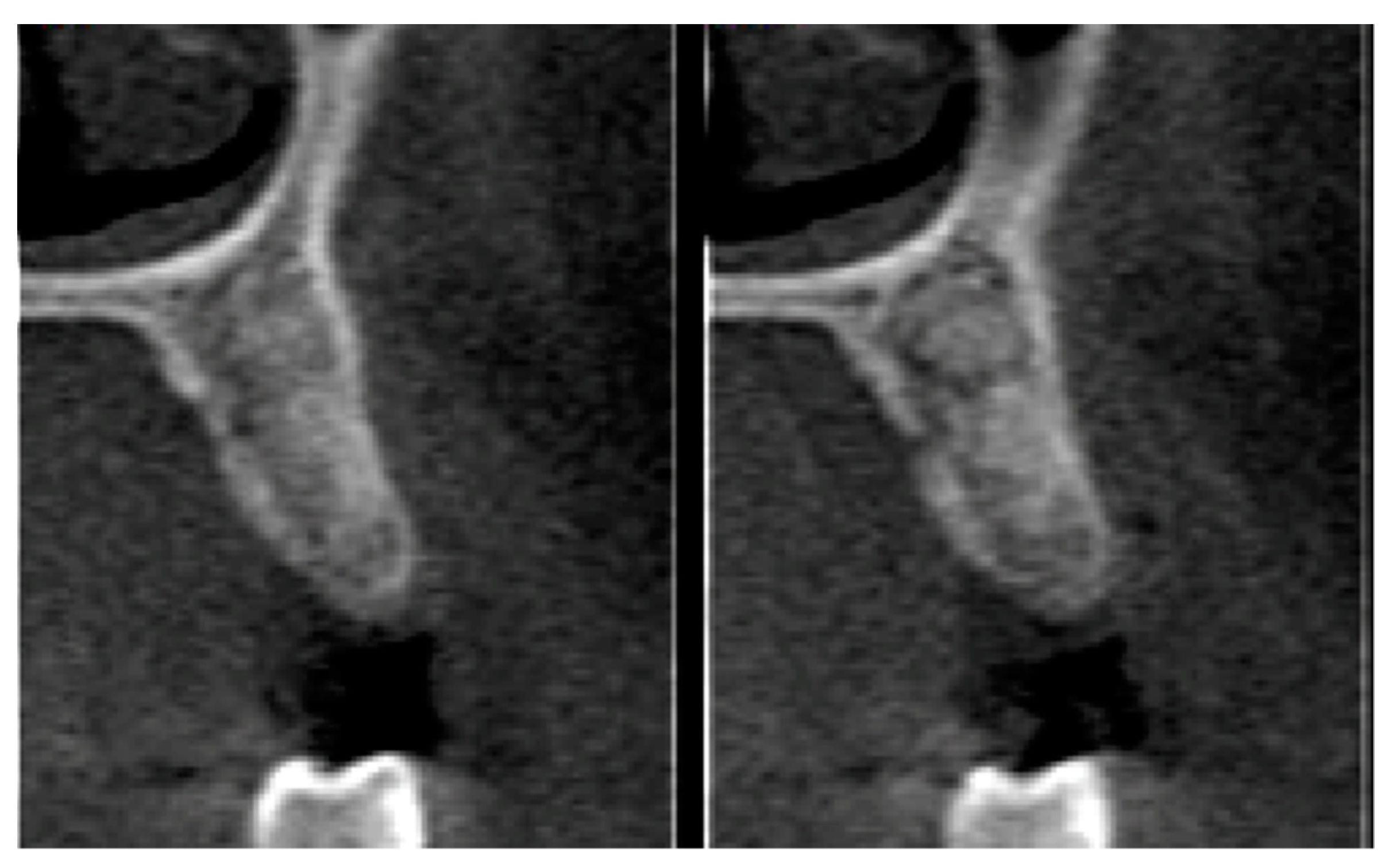 Materials 12 02902 g013