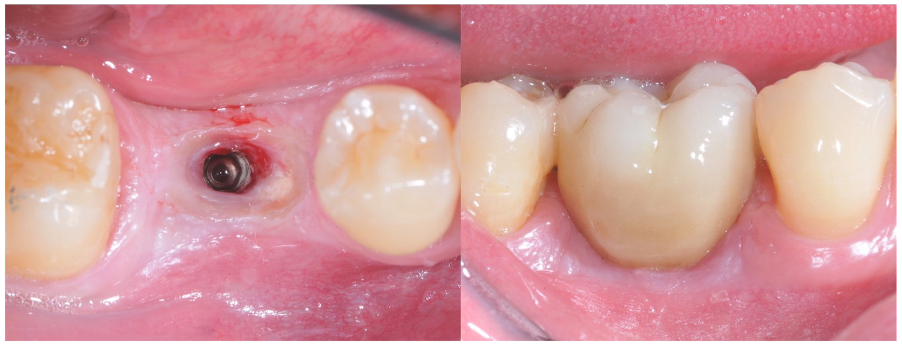 Materials 12 03041 g004