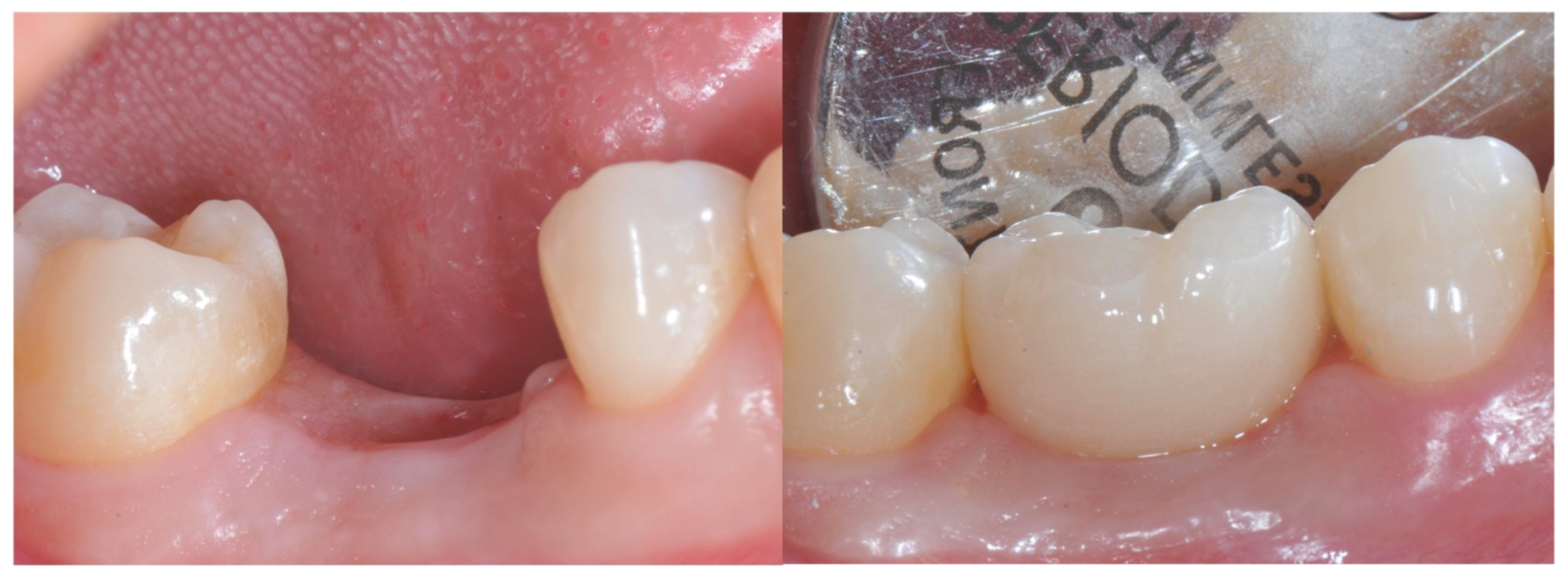 Materials 12 03041 g005