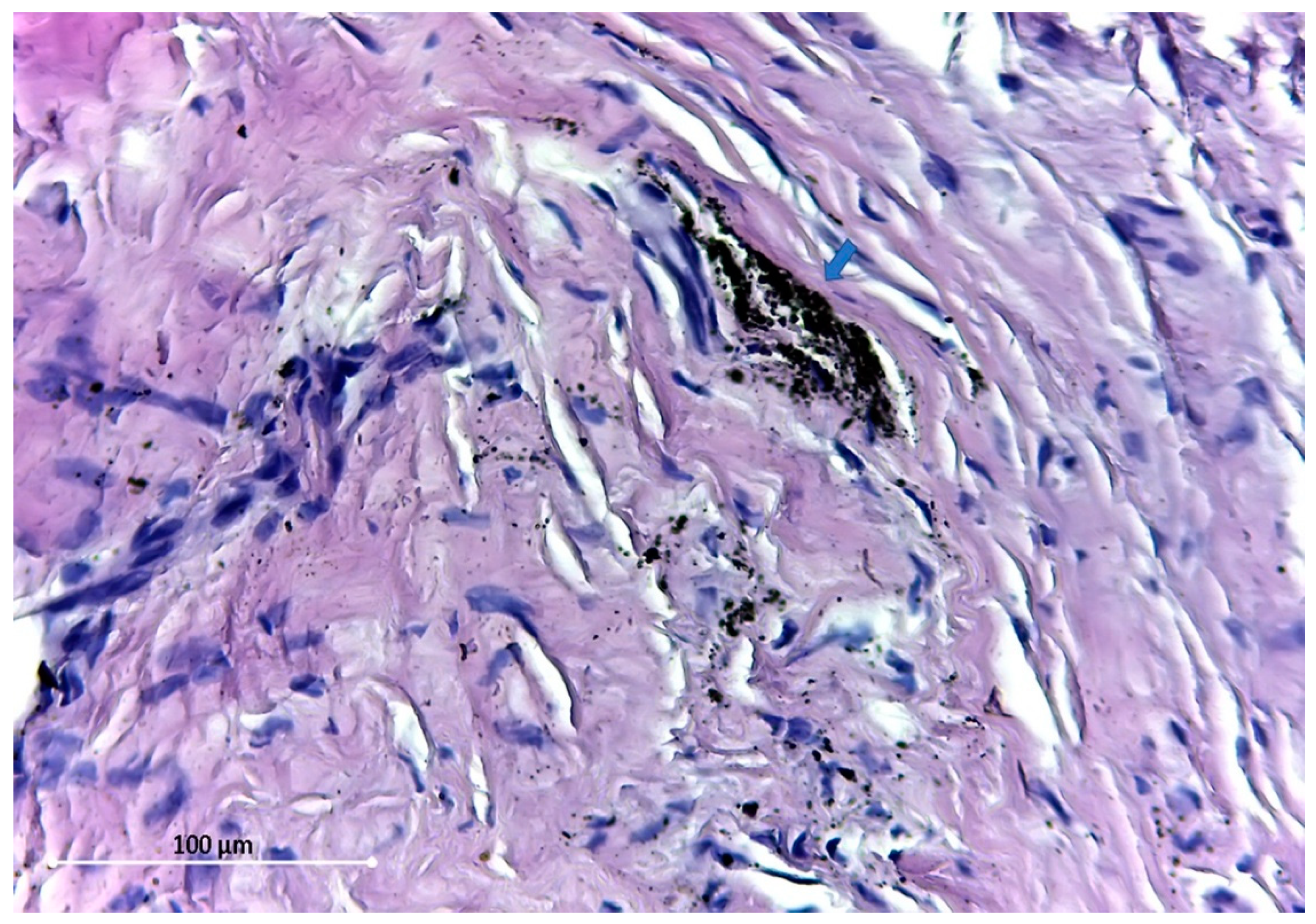 Materials 12 03205 g004