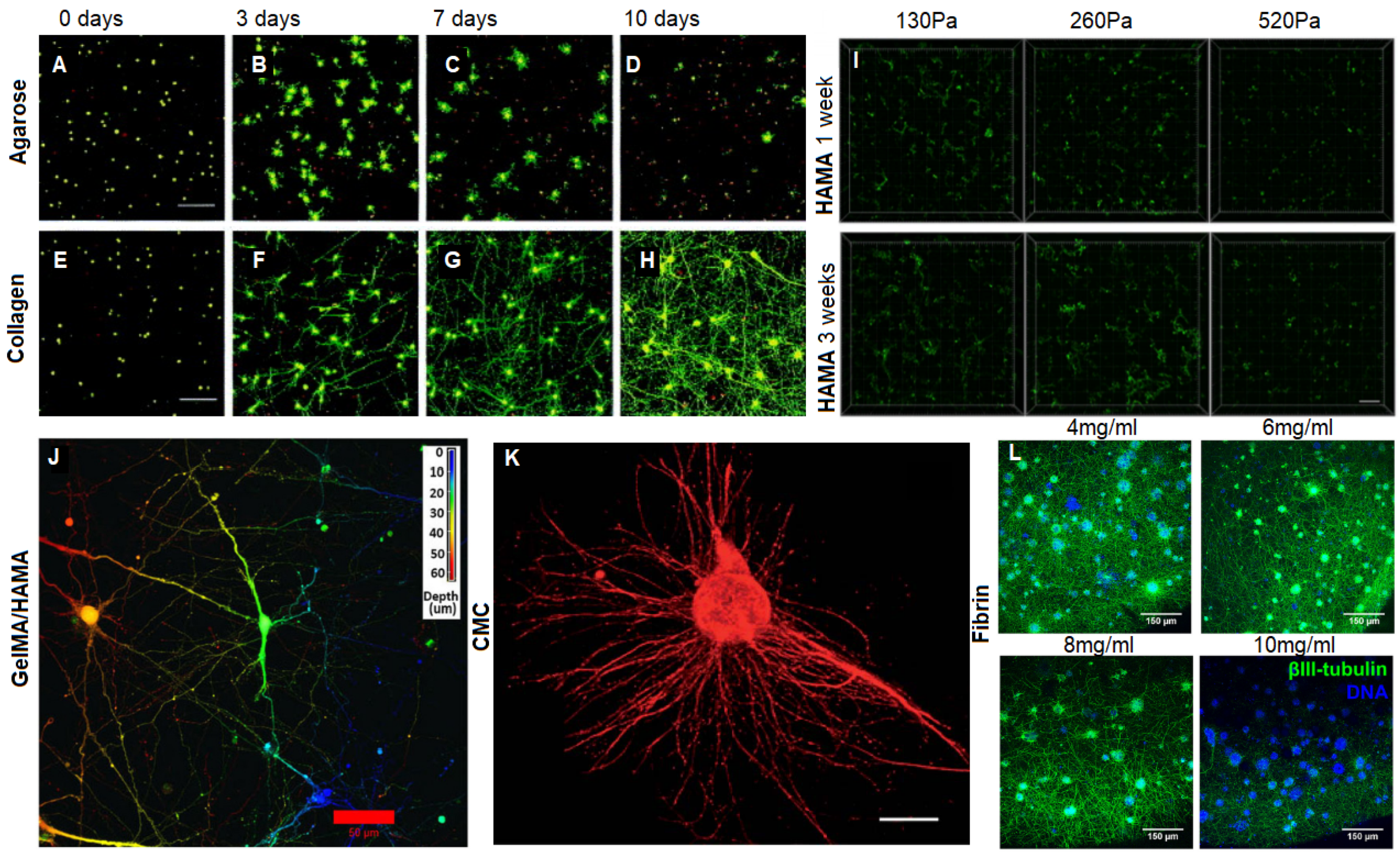 Materials Free Full Text Layer By Layer The Case For 3d Bioprinting Neurons To Create Patient Specific Epilepsy Models Materials Free Full Text Layer By Layer The Case For 3d Bioprinting Neurons To Create Patient Specific Epilepsy Models