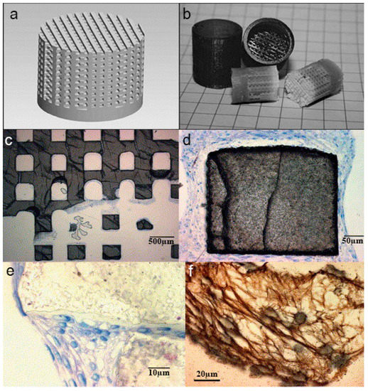 3D Printing of Bioceramics for Bone Tissue Engineering