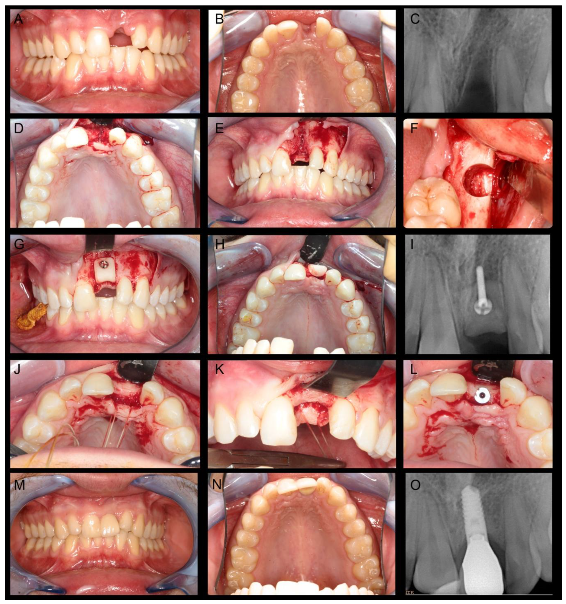 Materials 12 03802 g002 550