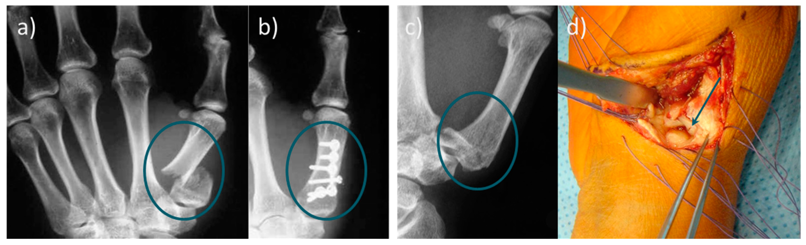 Materials 12 03975 g001 Materials 12 03975 g001