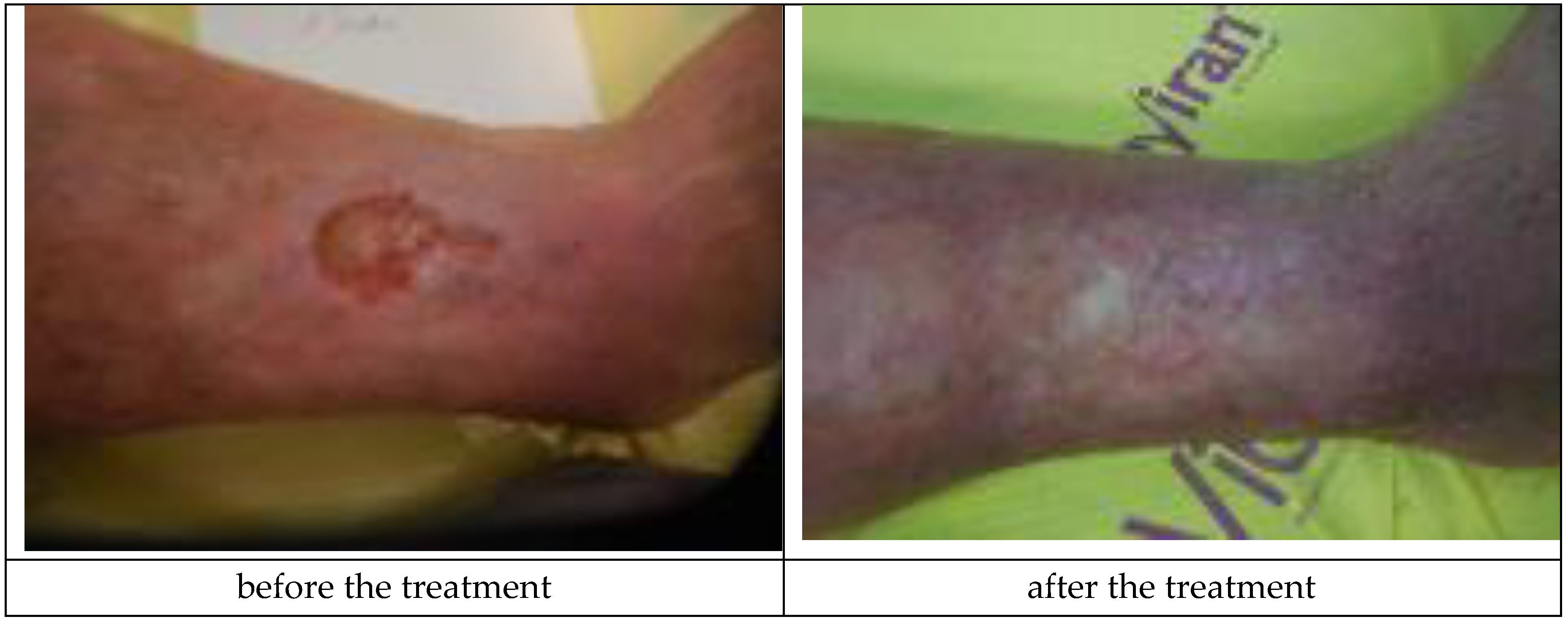 Materials 12 04170 g005