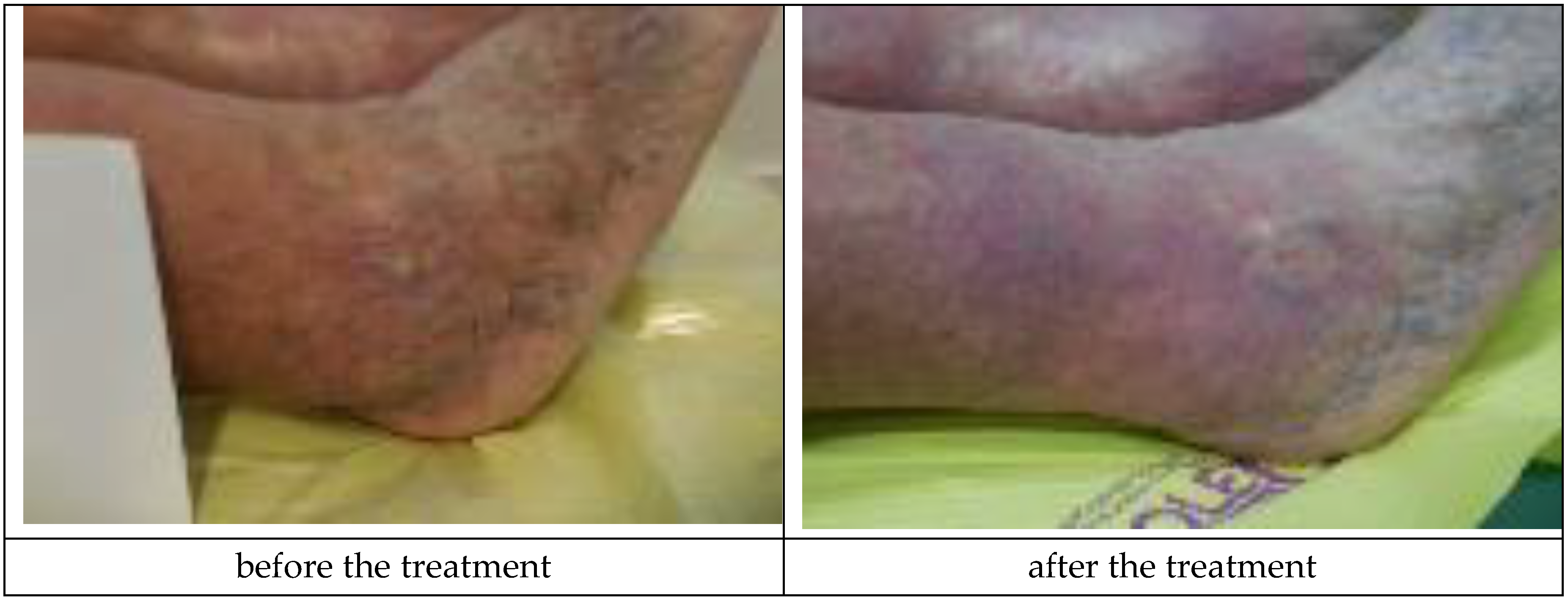 Materials 12 04170 g006