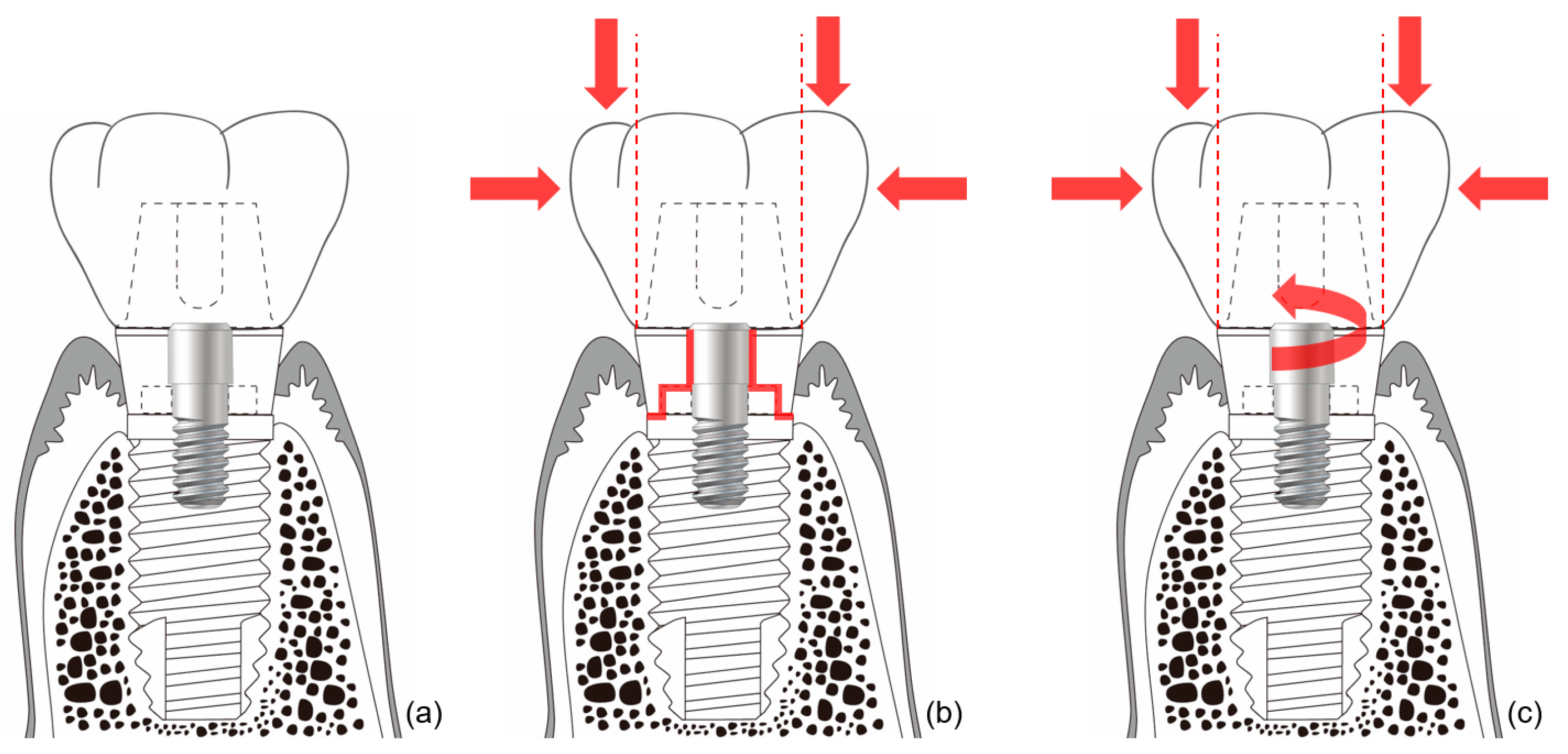 Materials 13 00072 g004 Materials 13 00072 g004