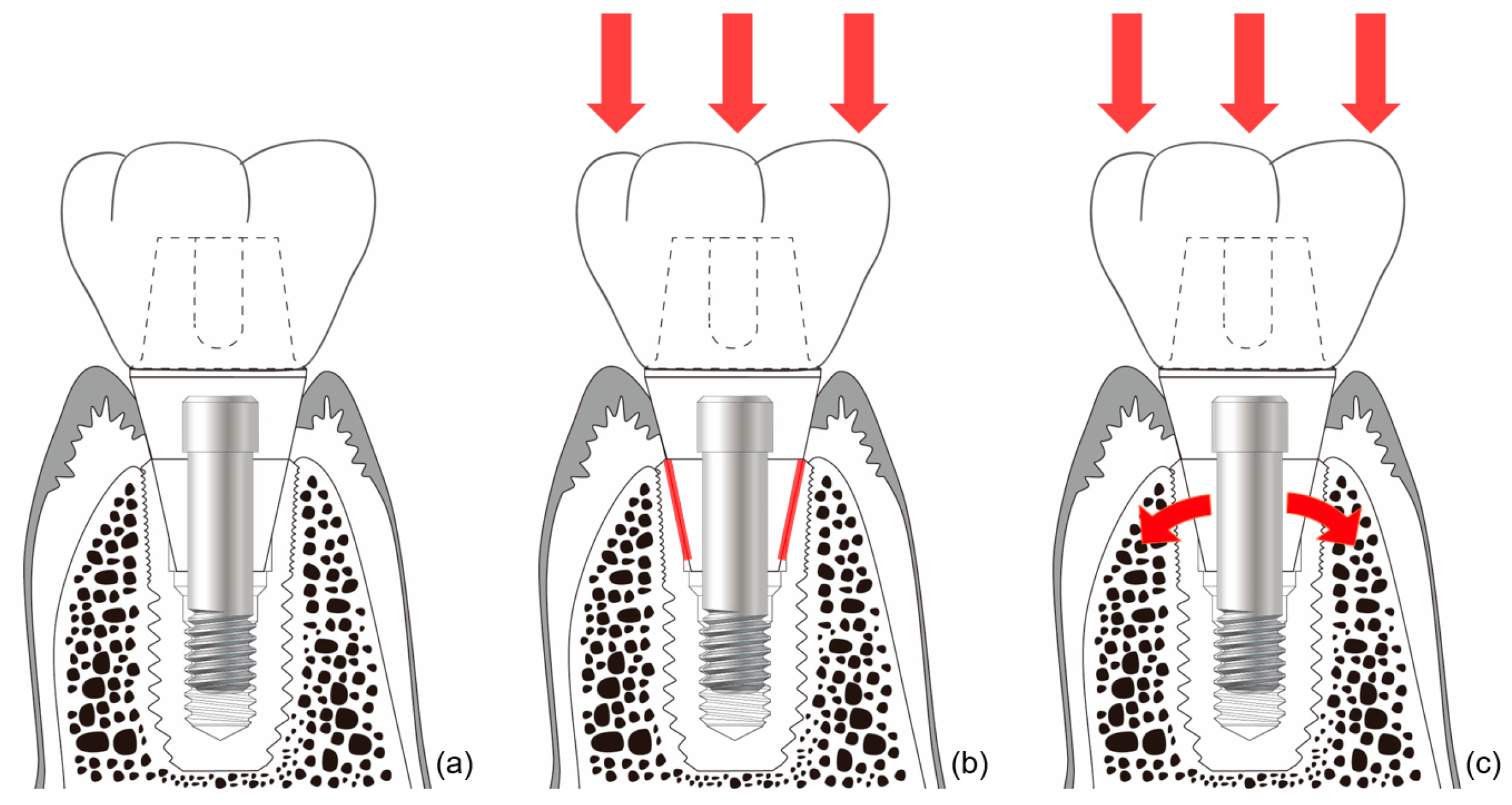 Materials 13 00072 g006 Materials 13 00072 g006