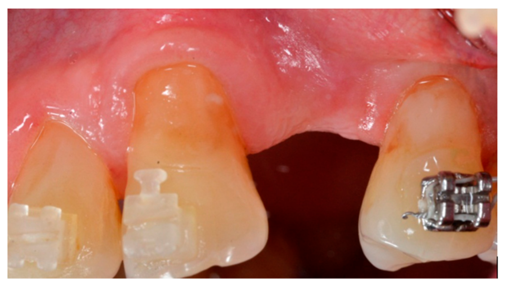 Materials 13 00511 g001 Materials 13 00511 g001