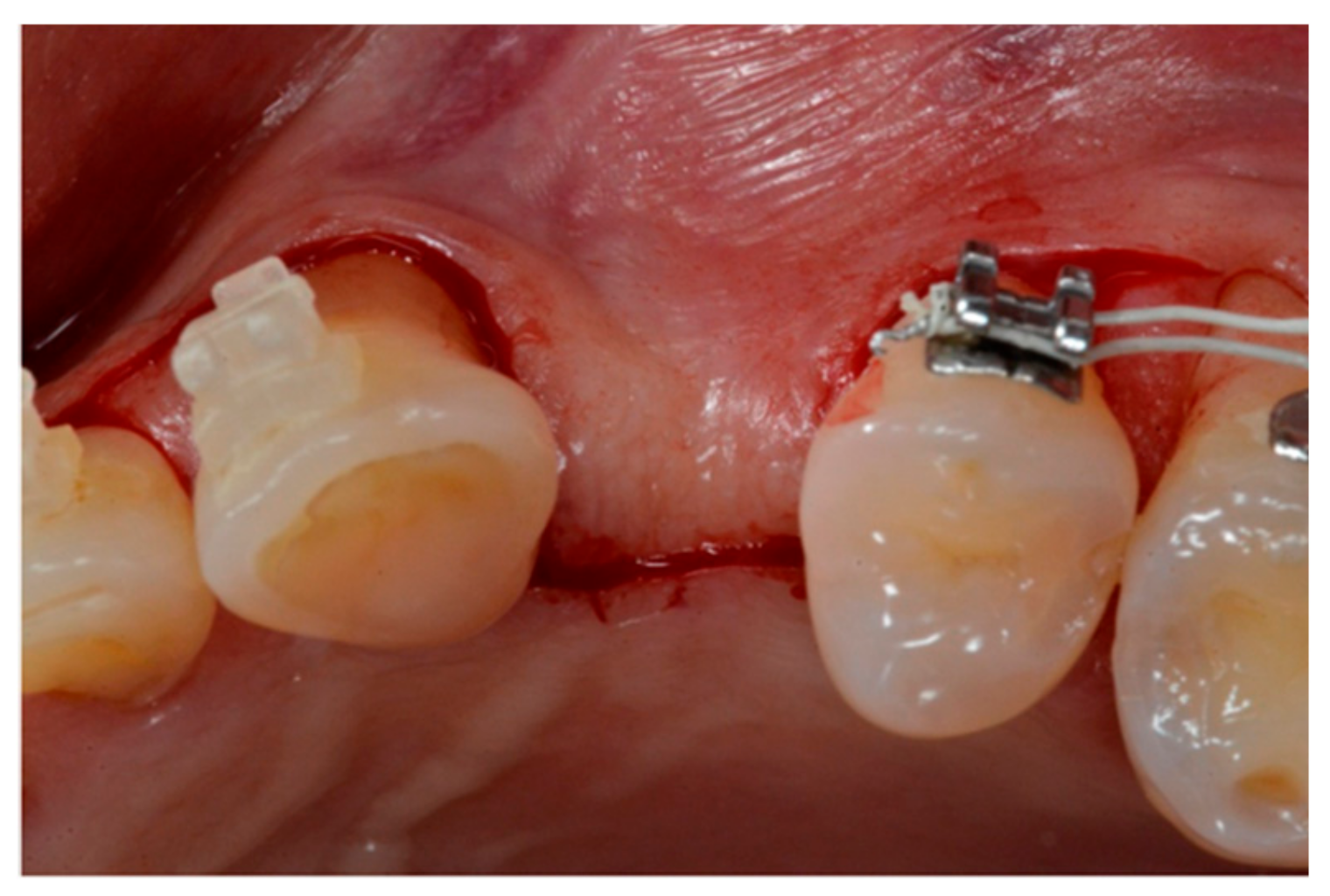 Materials 13 00511 g002 Materials 13 00511 g002