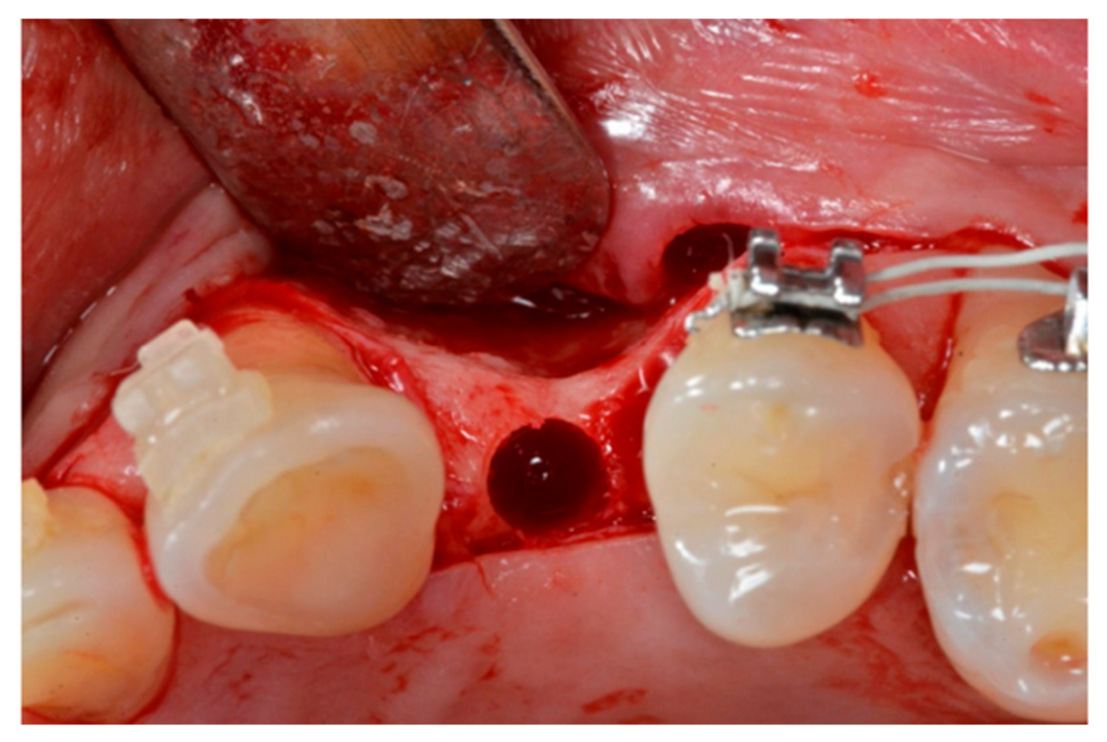 Materials 13 00511 g003 Materials 13 00511 g003