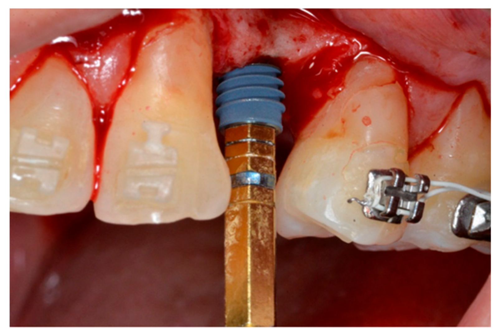 Materials 13 00511 g004 Materials 13 00511 g004