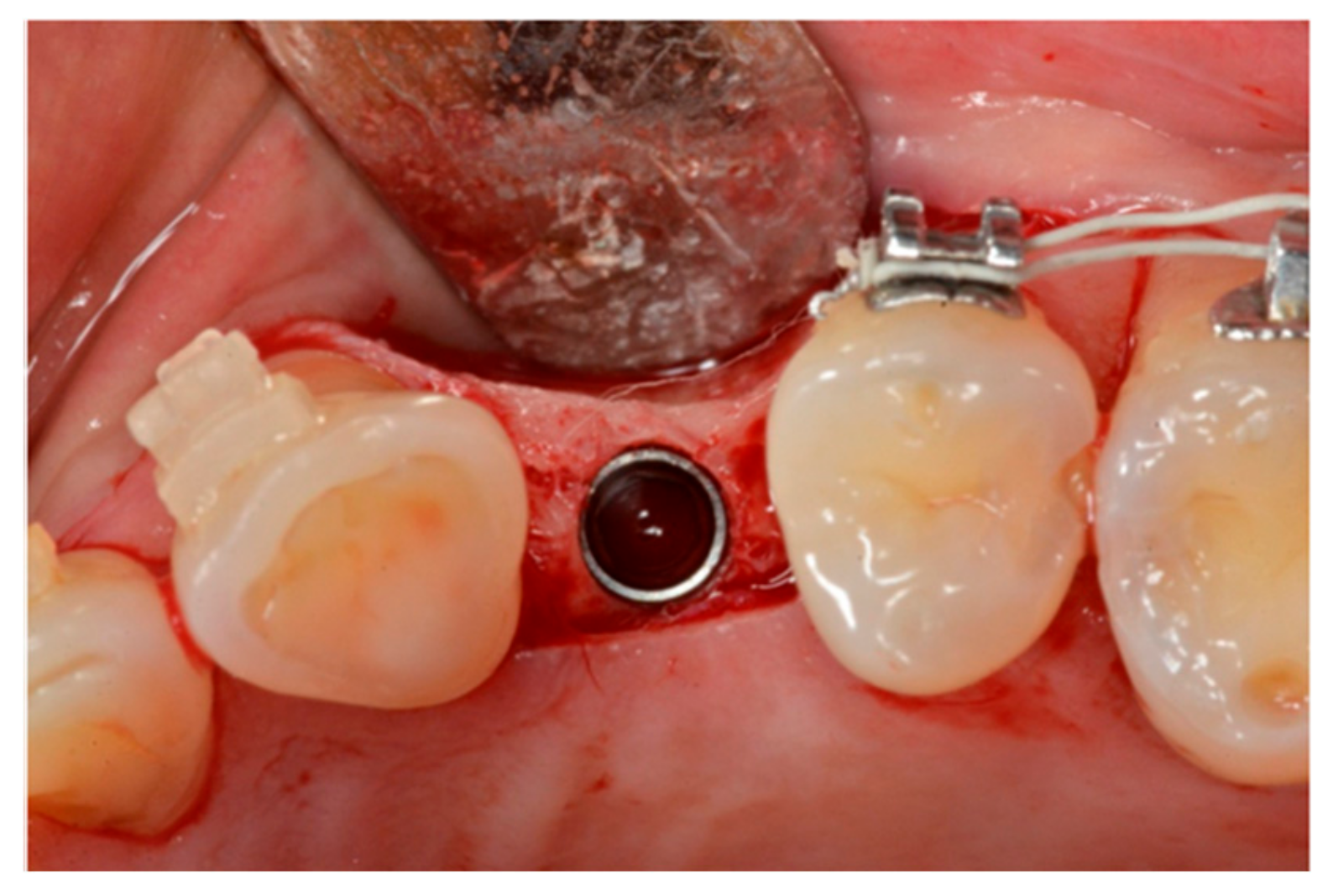 Materials 13 00511 g005 Materials 13 00511 g005