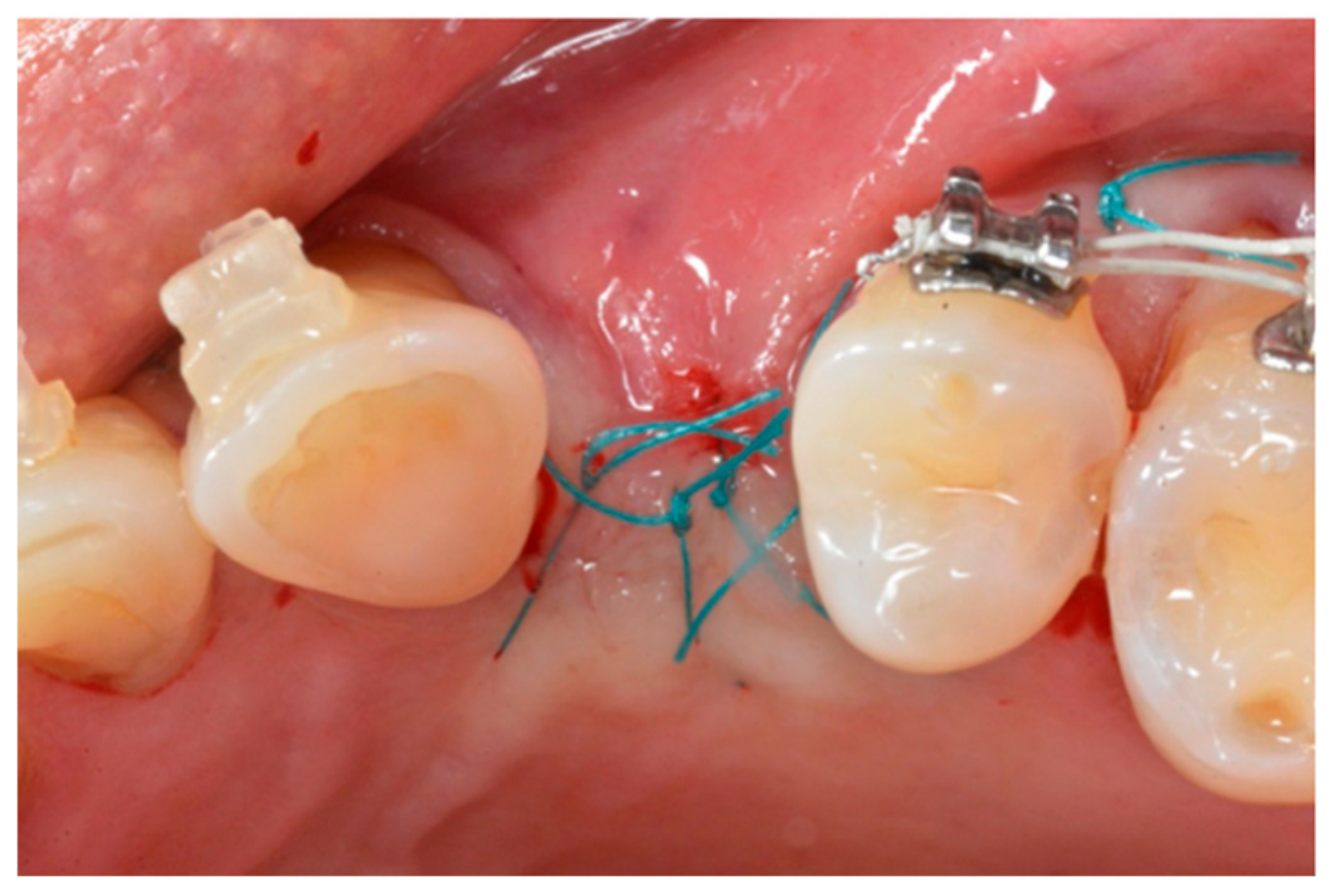 Materials 13 00511 g006 Materials 13 00511 g006