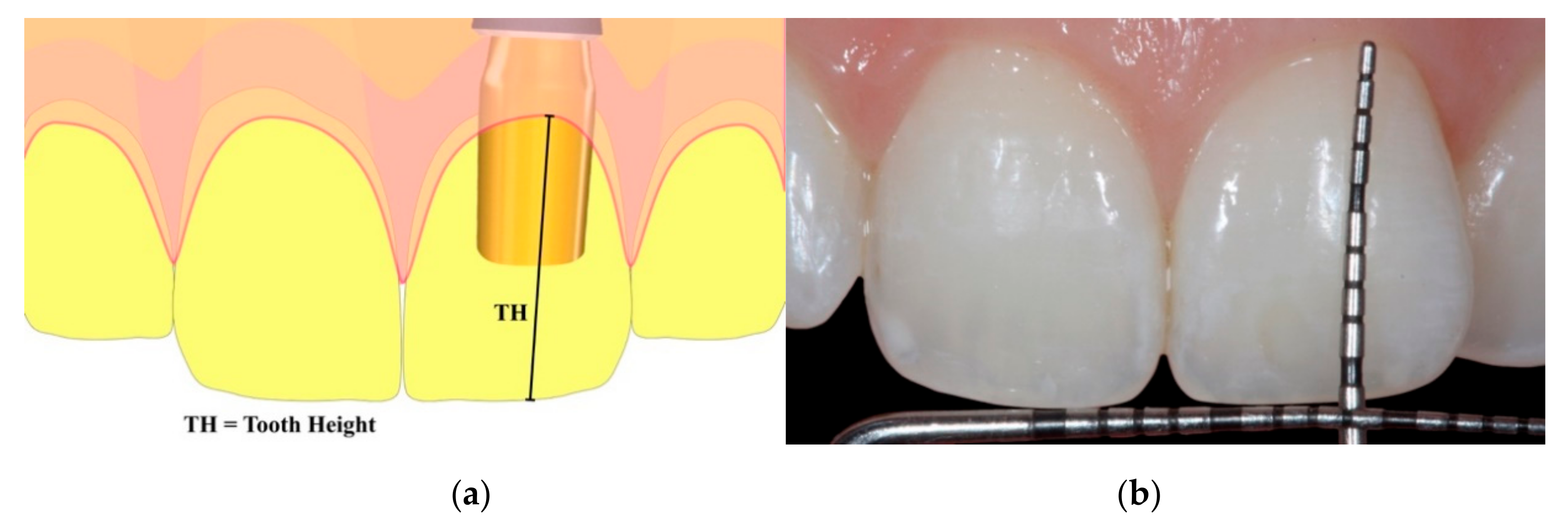 Materials 13 00511 g009 Materials 13 00511 g009