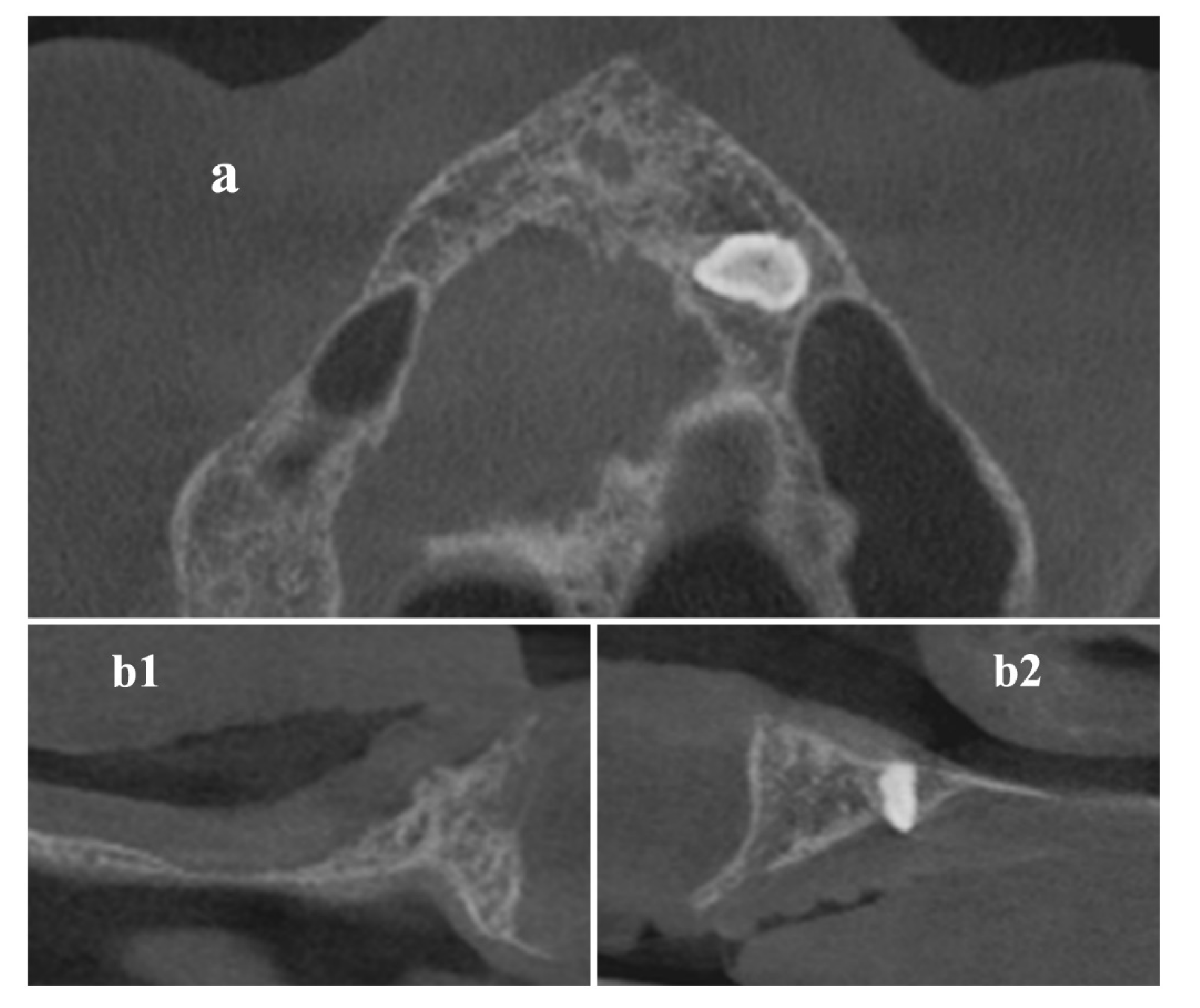 Materials 13 01393 g001 Materials 13 01393 g001