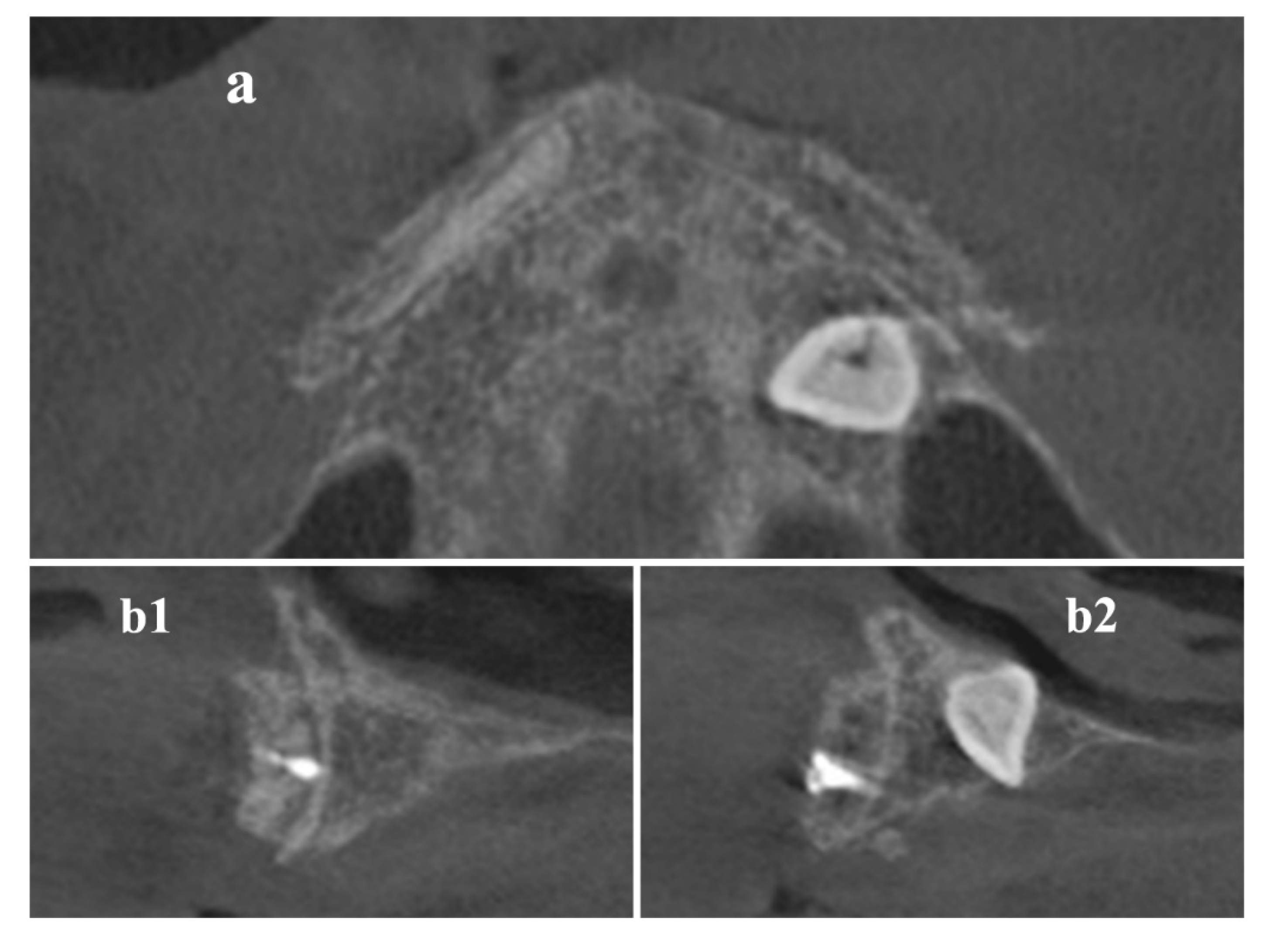 Materials 13 01393 g005 Materials 13 01393 g005