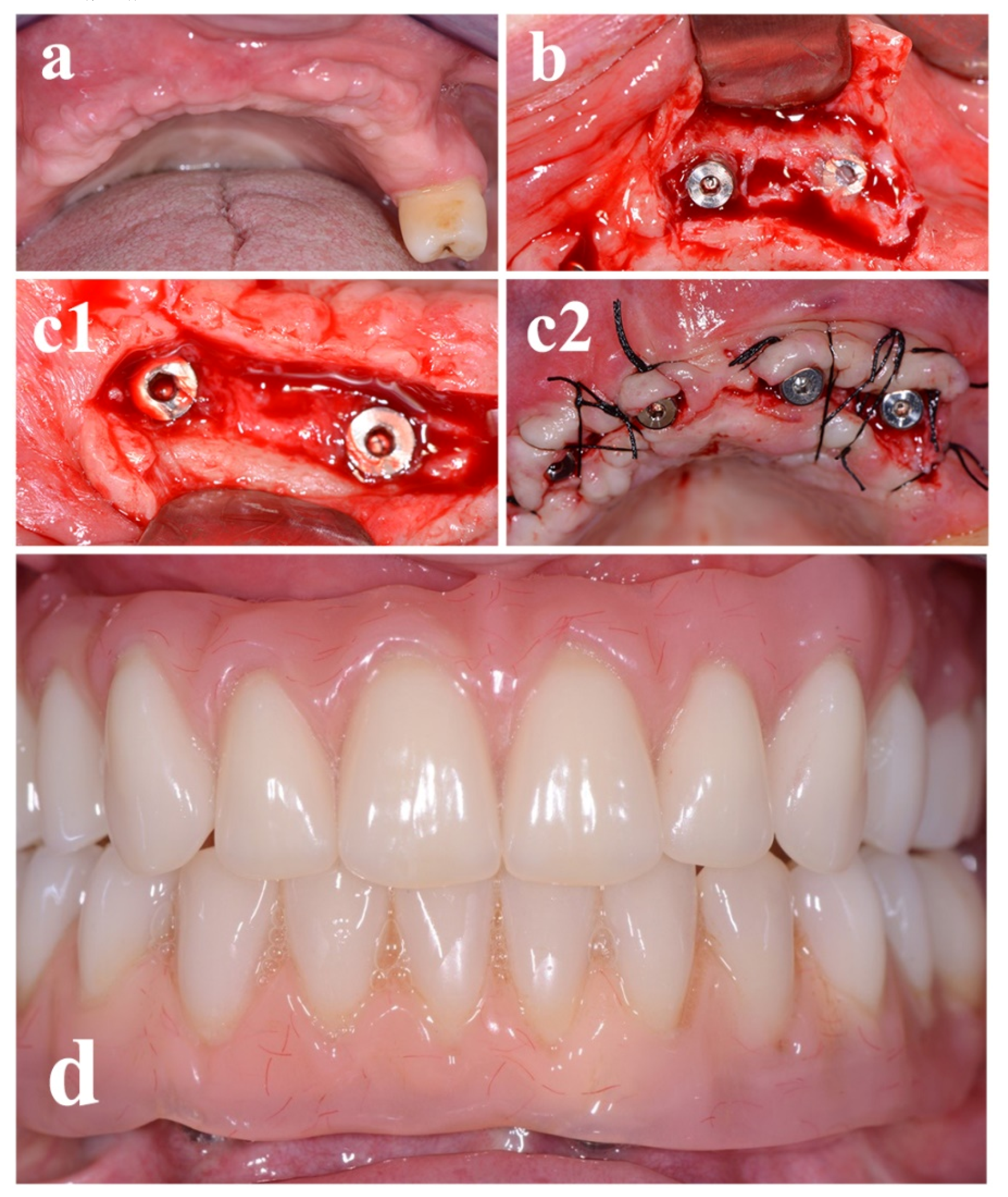 Materials 13 01393 g006 Materials 13 01393 g006
