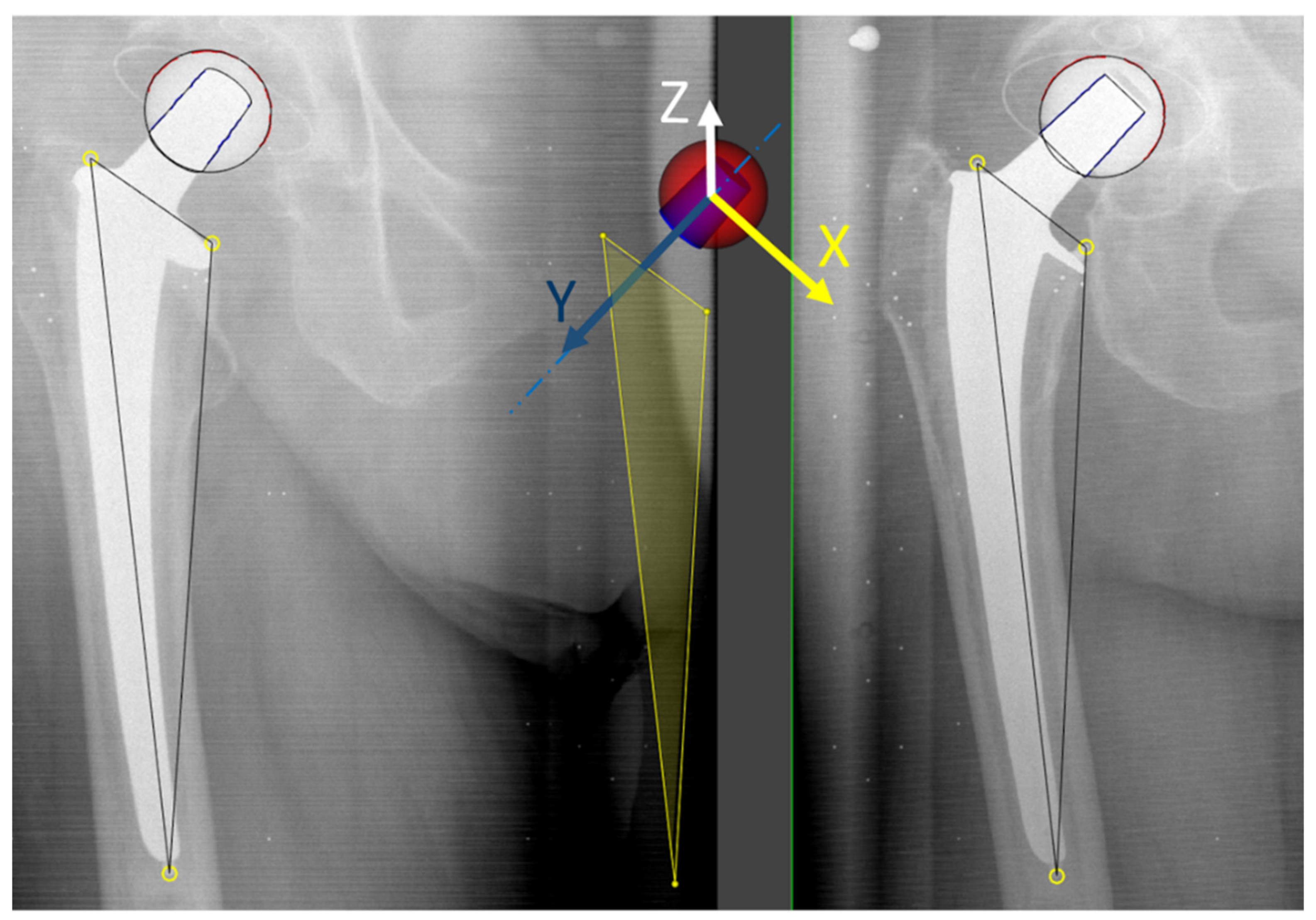 Materials 13 01543 g002 Materials 13 01543 g002