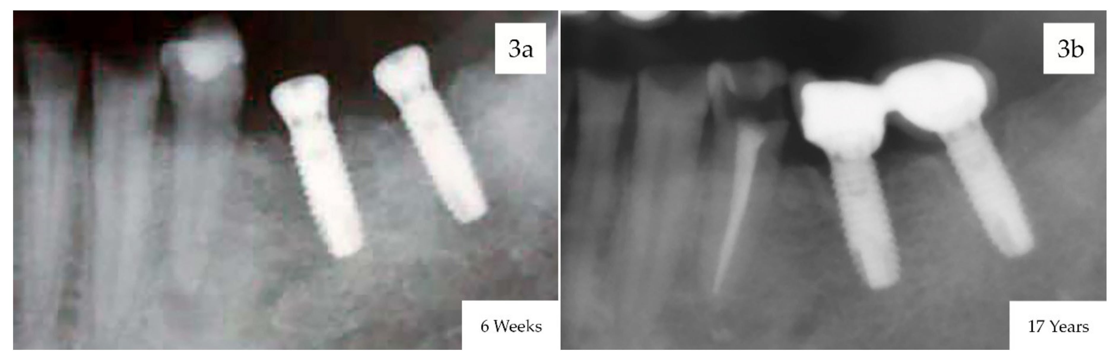 Materials 13 01553 g003