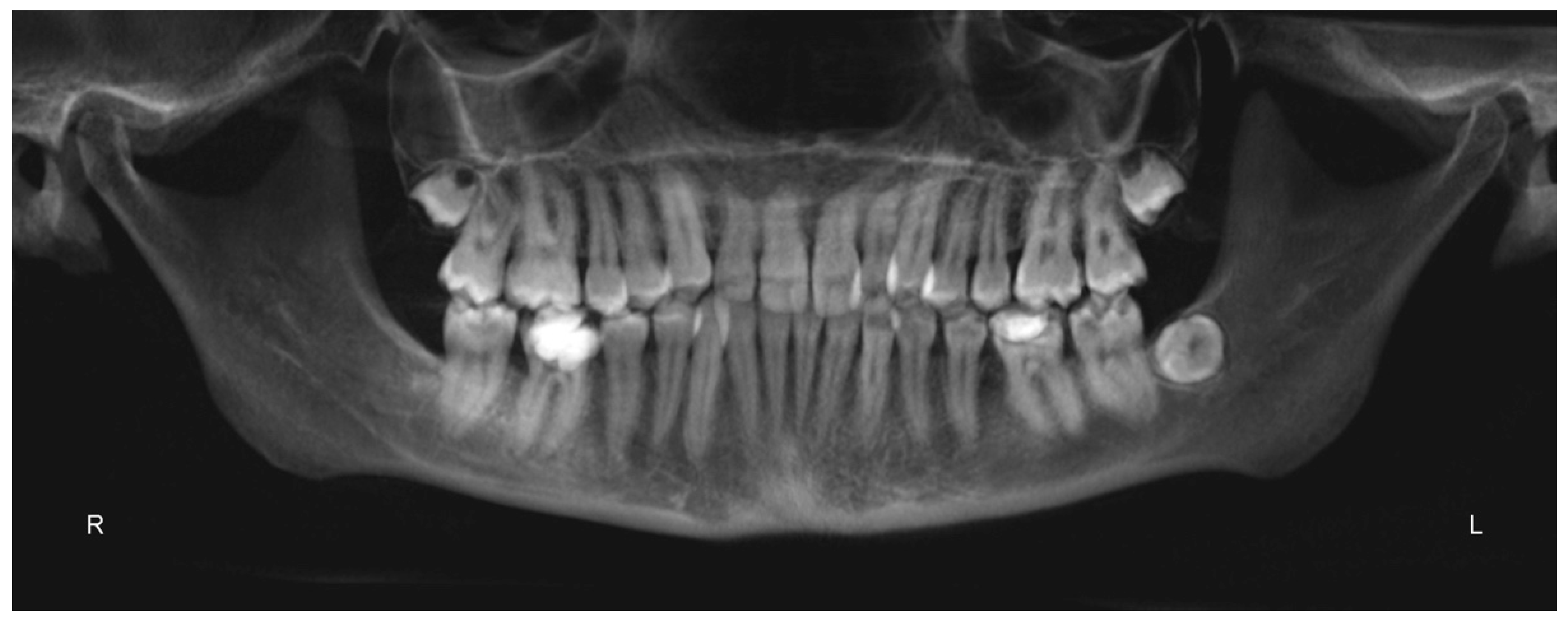 Materials 13 01815 g009