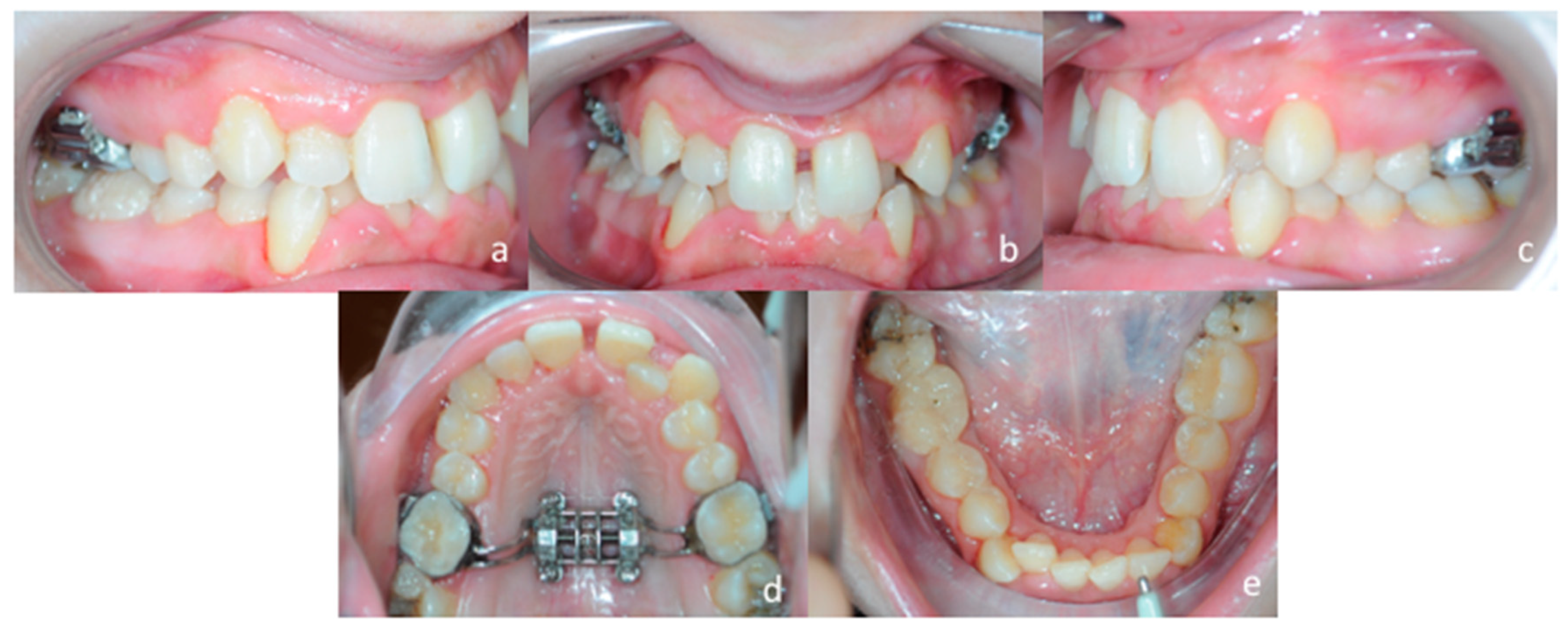 Materials 13 01815 g012