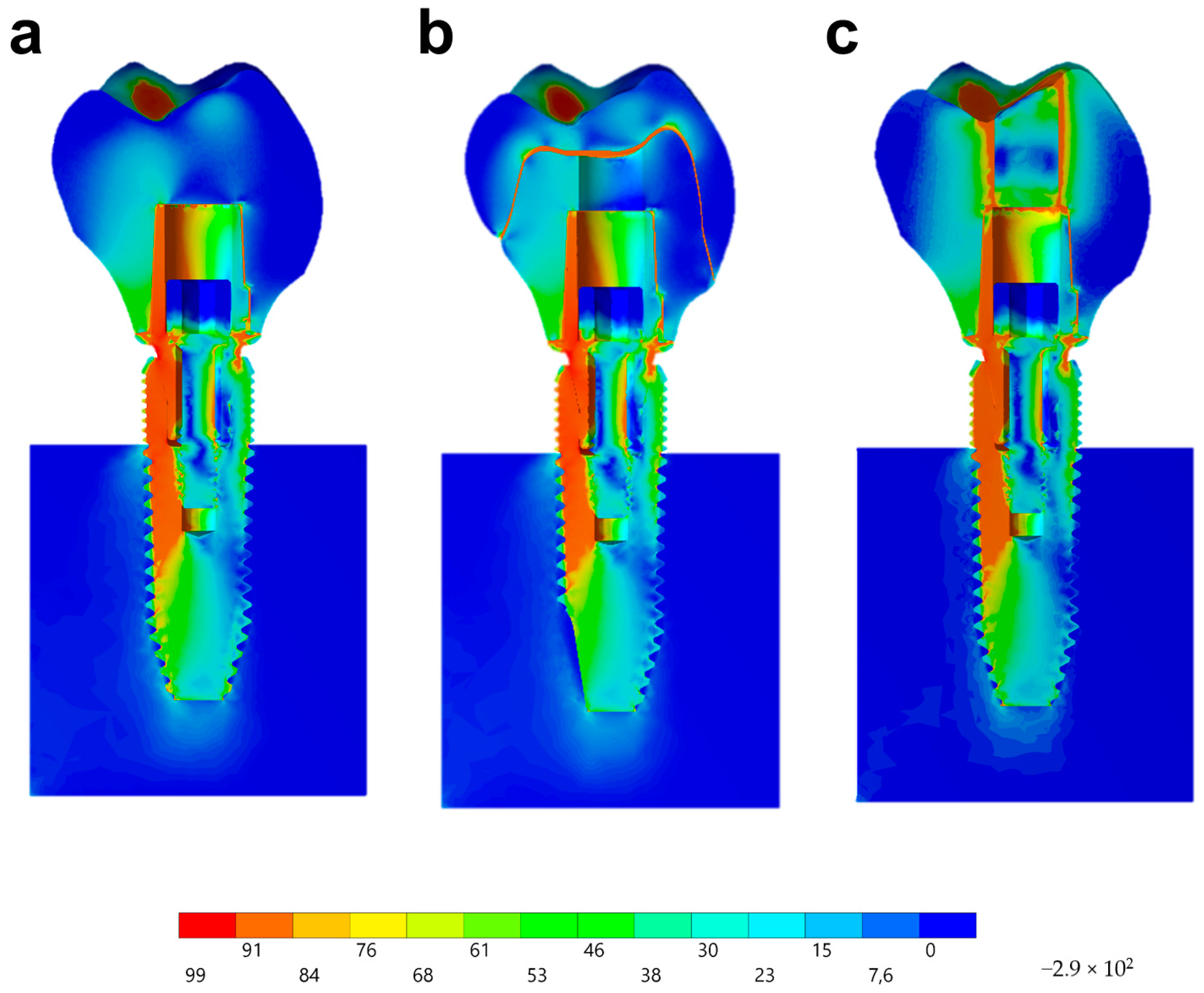 Materials 13 01879 g014 Materials 13 01879 g014