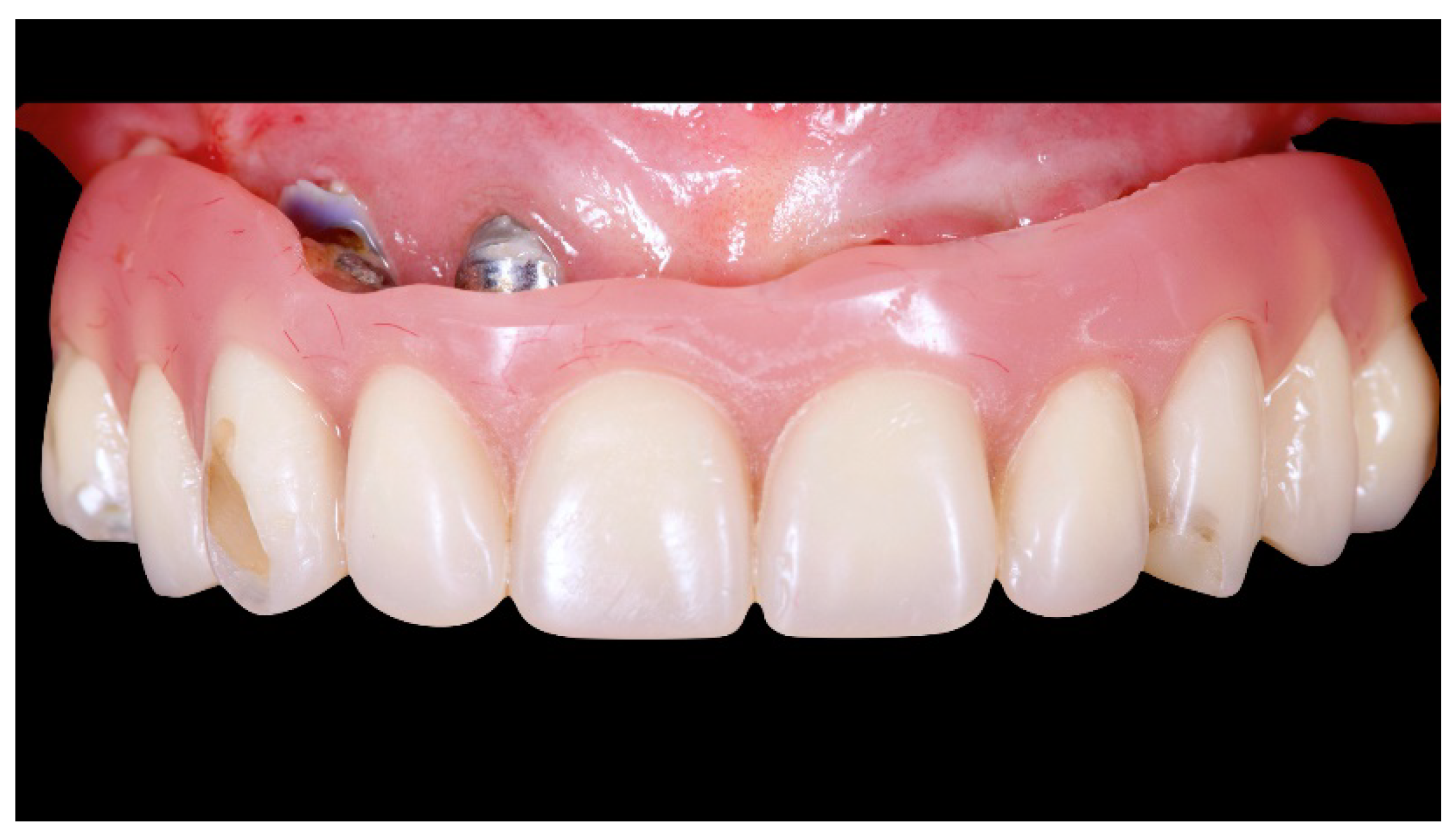 Materials 13 01883 g001 Materials 13 01883 g001