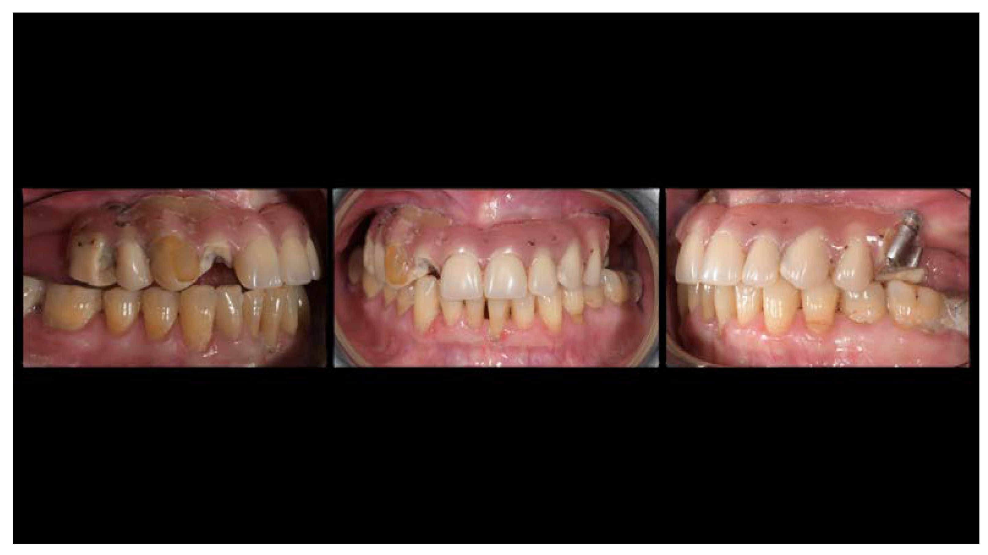 Materials 13 01883 g002 Materials 13 01883 g002