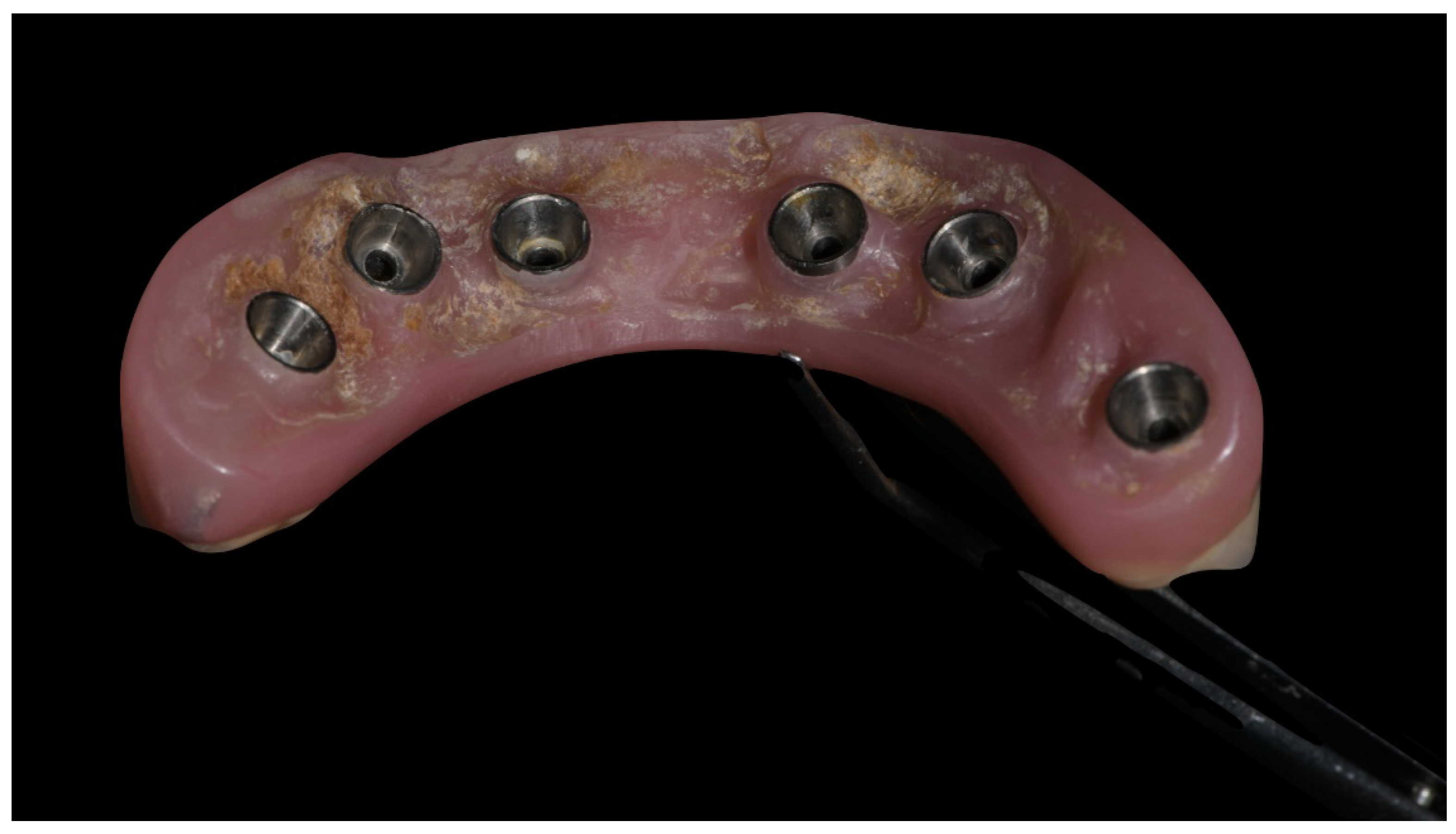 Materials 13 01883 g003 Materials 13 01883 g003