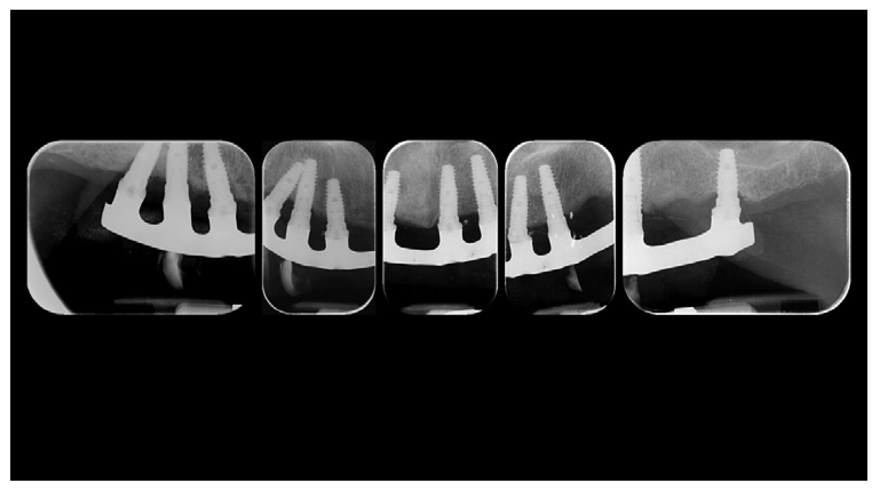 Materials 13 01883 g004 Materials 13 01883 g004