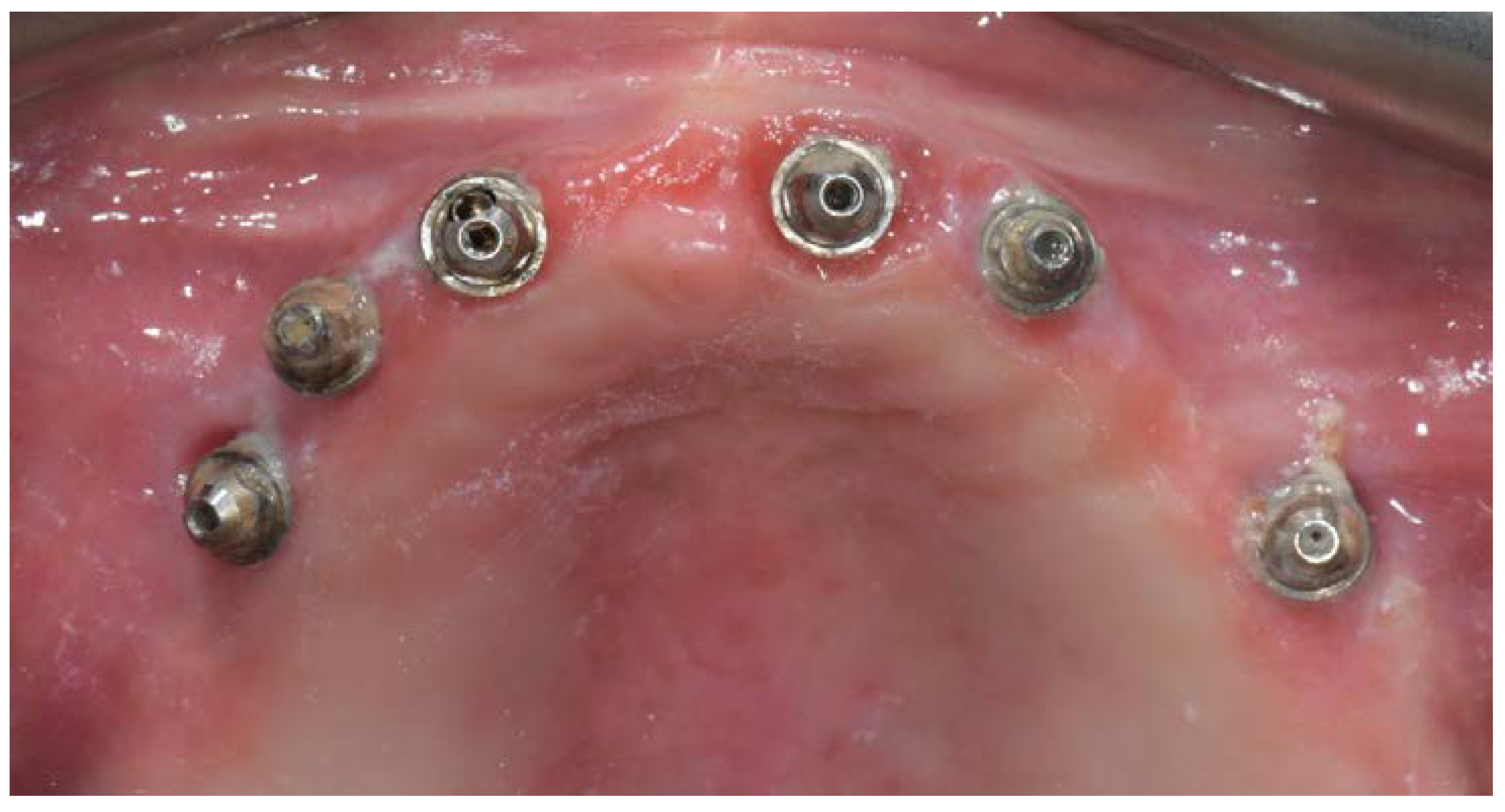 Materials 13 01883 g005 Materials 13 01883 g005