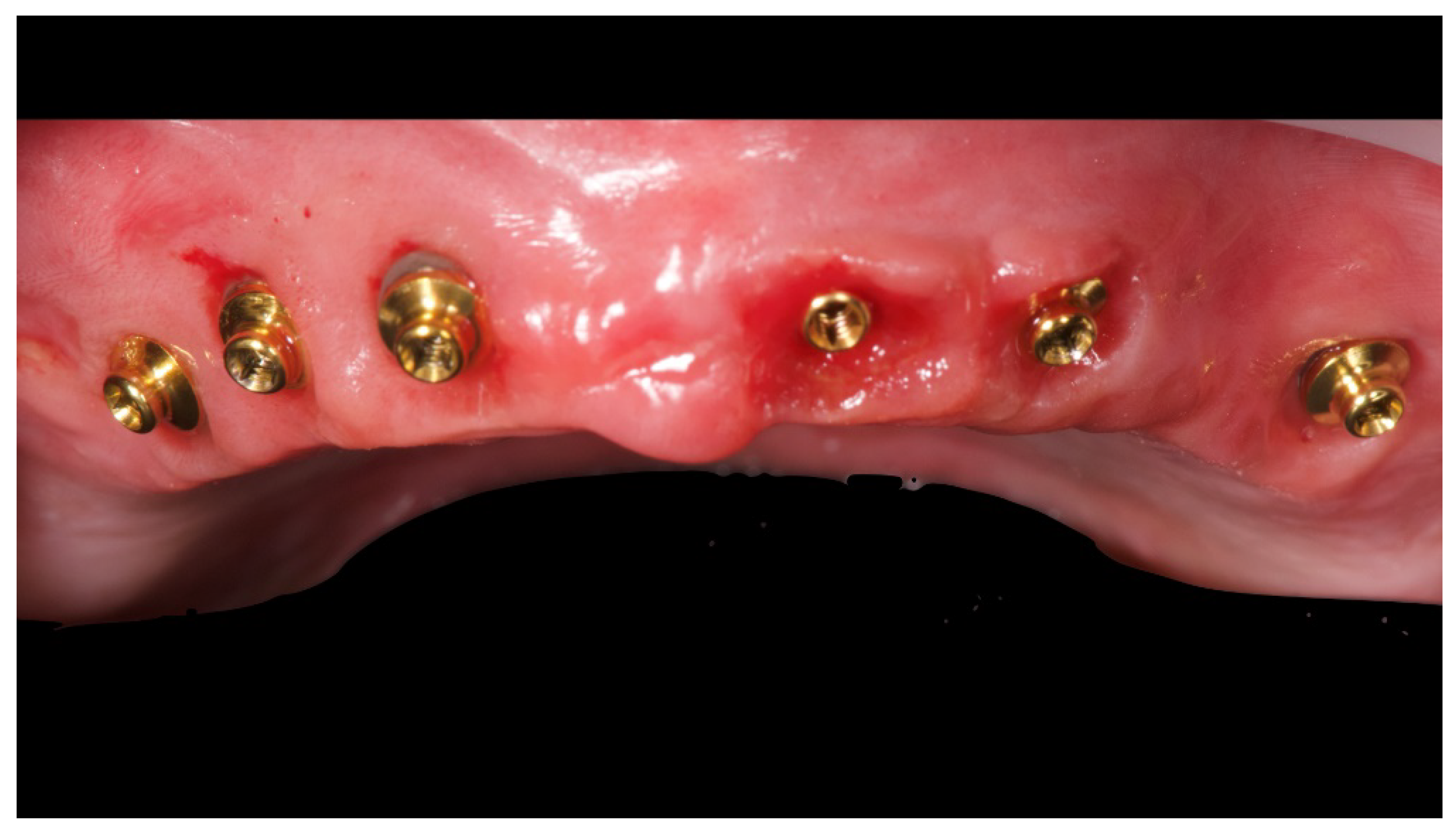 Materials 13 01883 g006 Materials 13 01883 g006