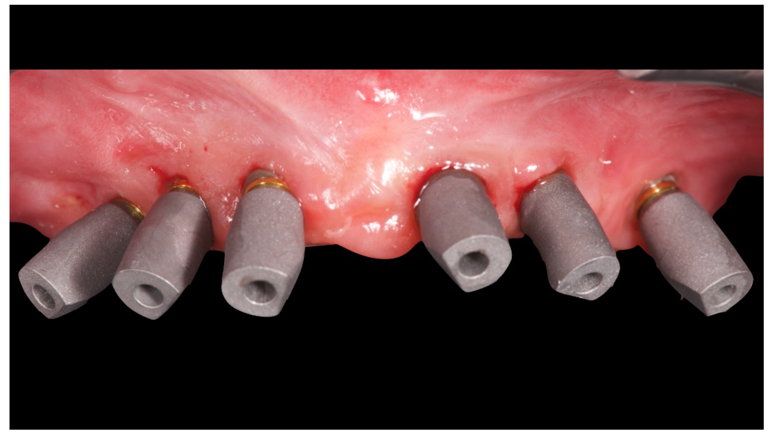 Materials 13 01883 g007 Materials 13 01883 g007