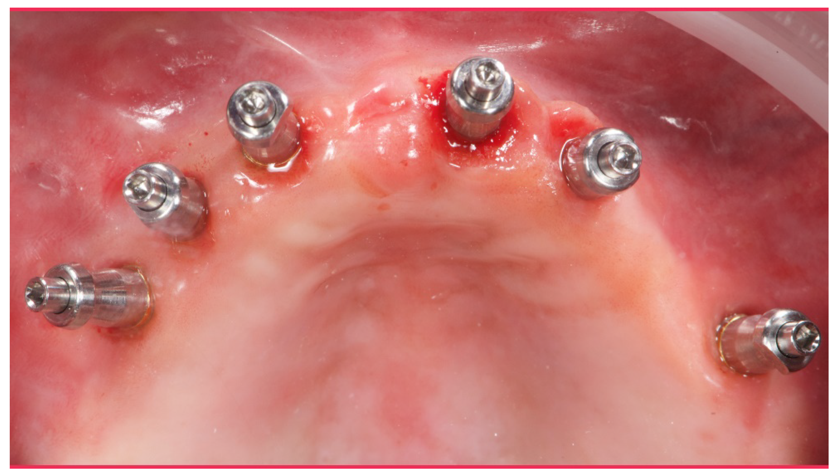 Materials 13 01883 g008 Materials 13 01883 g008