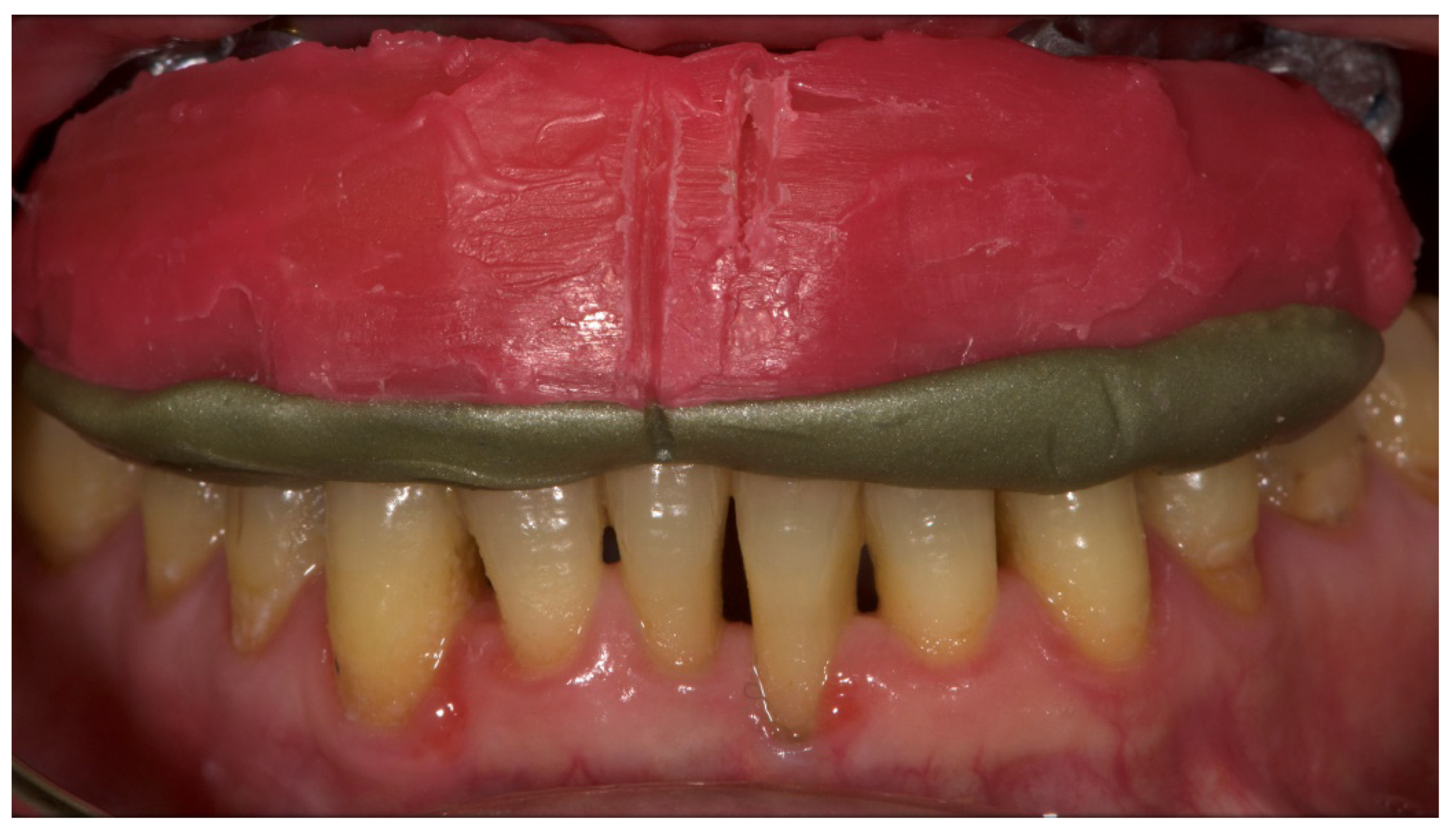 Materials 13 01883 g010 Materials 13 01883 g010