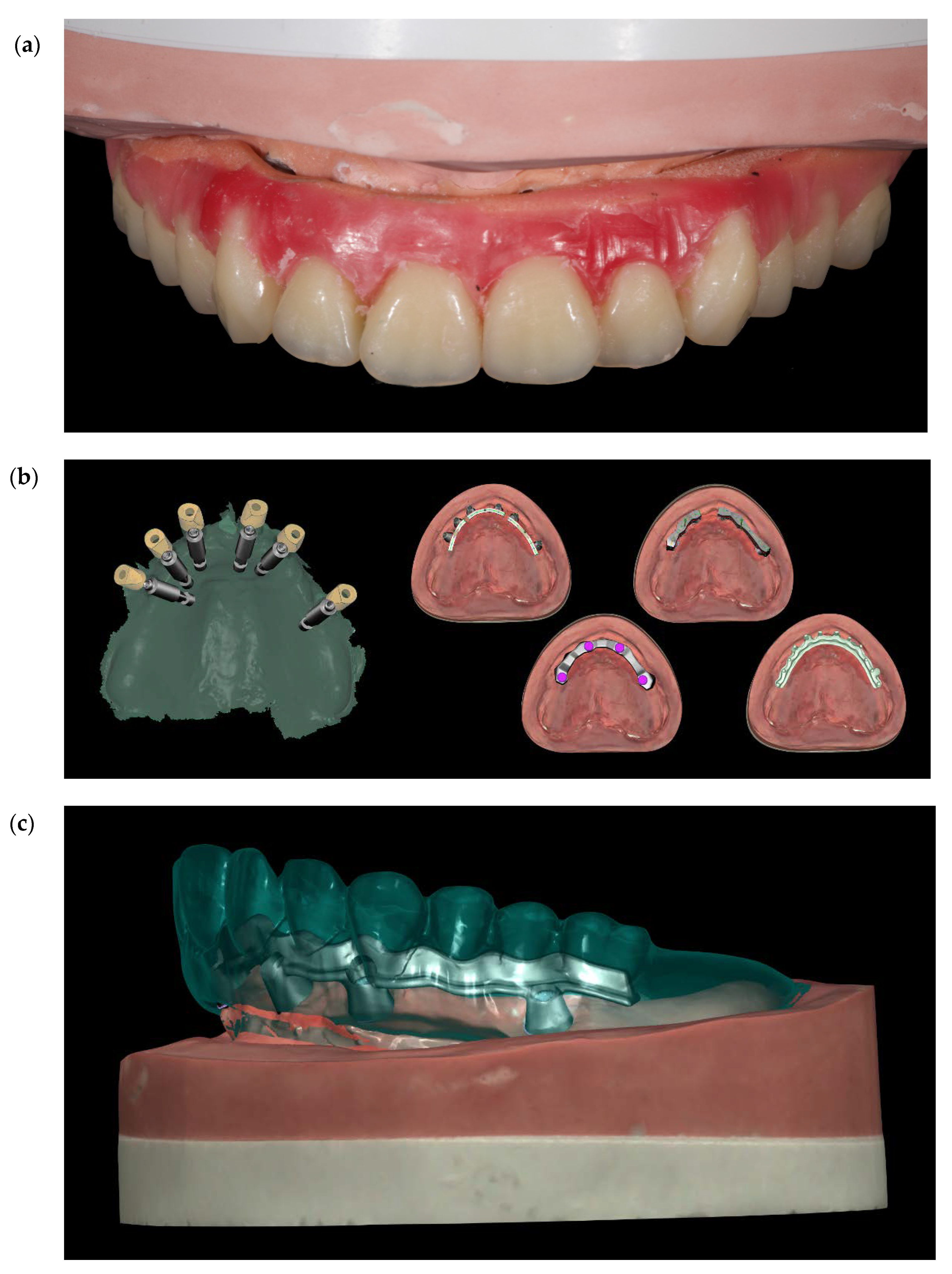 Materials 13 01883 g011 Materials 13 01883 g011