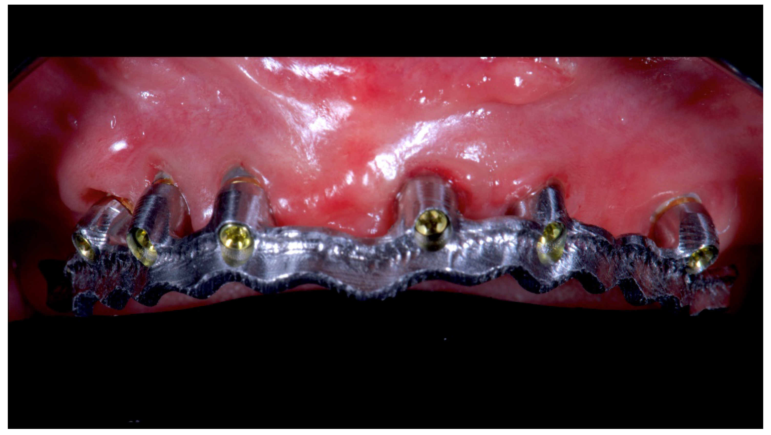 Materials 13 01883 g012 Materials 13 01883 g012