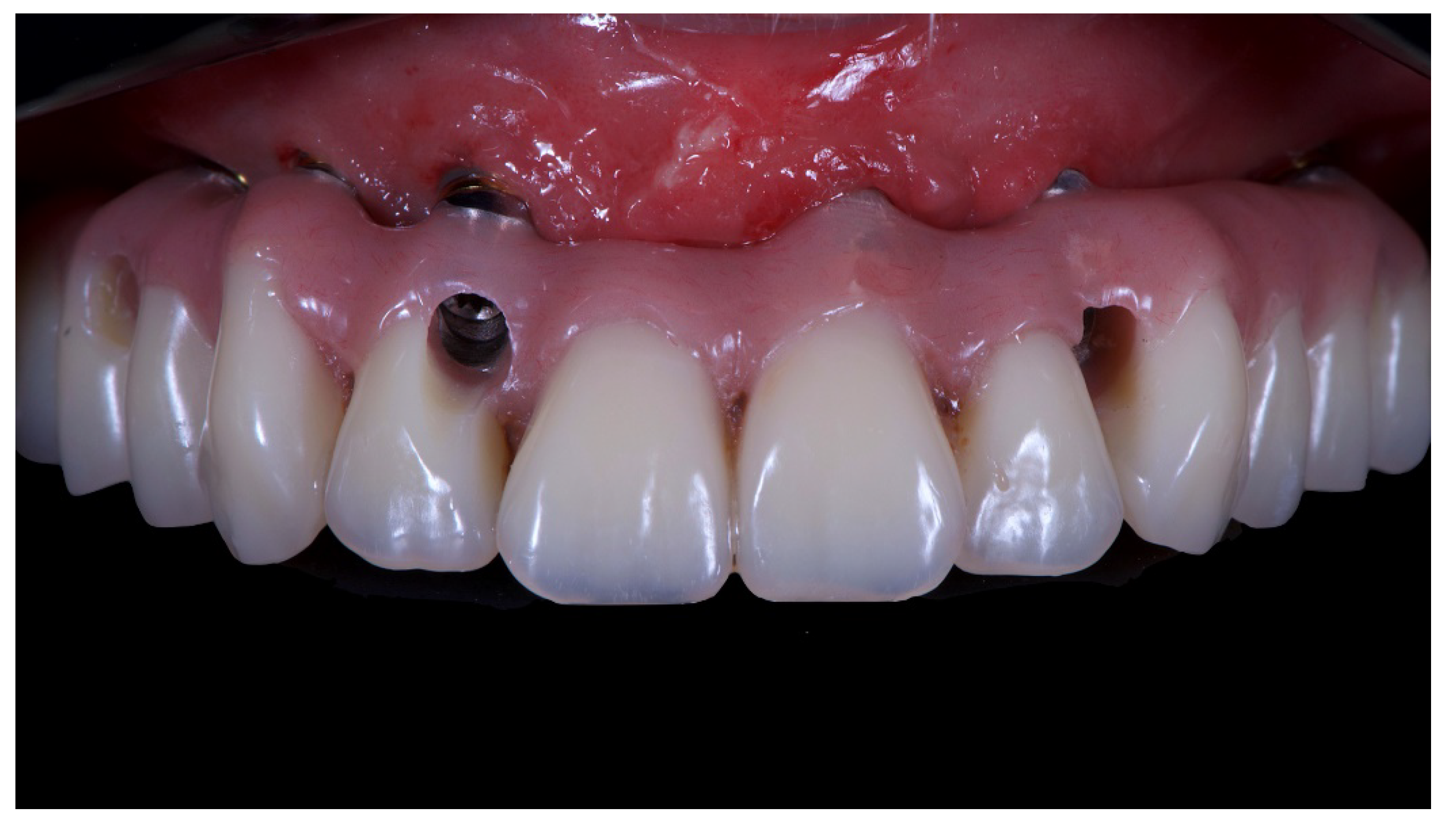 Materials 13 01883 g013 Materials 13 01883 g013