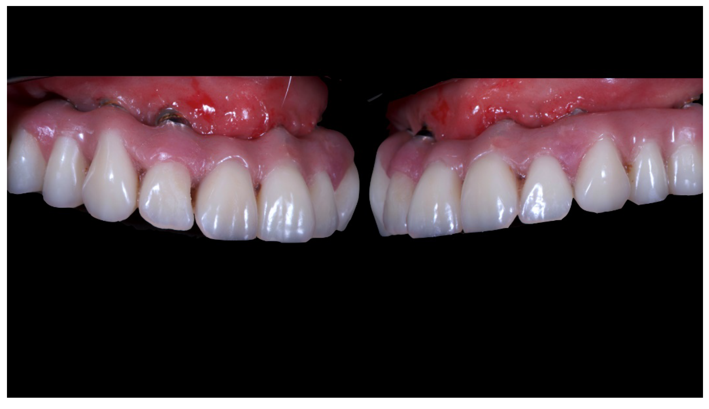 Materials 13 01883 g014 Materials 13 01883 g014