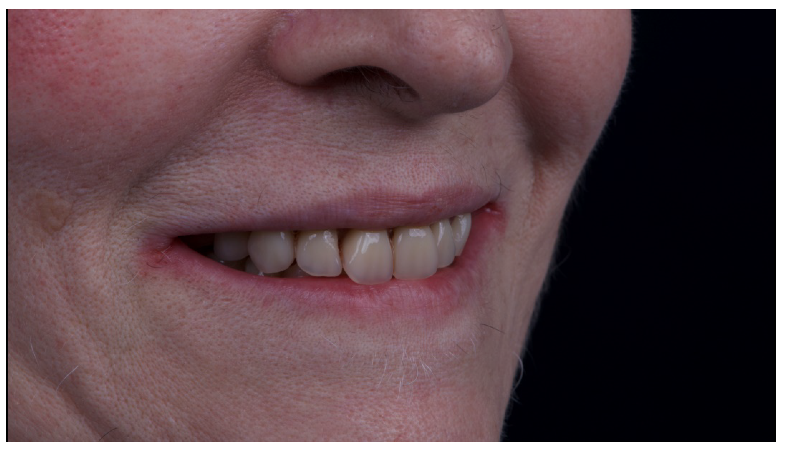 Materials 13 01883 g015 Materials 13 01883 g015