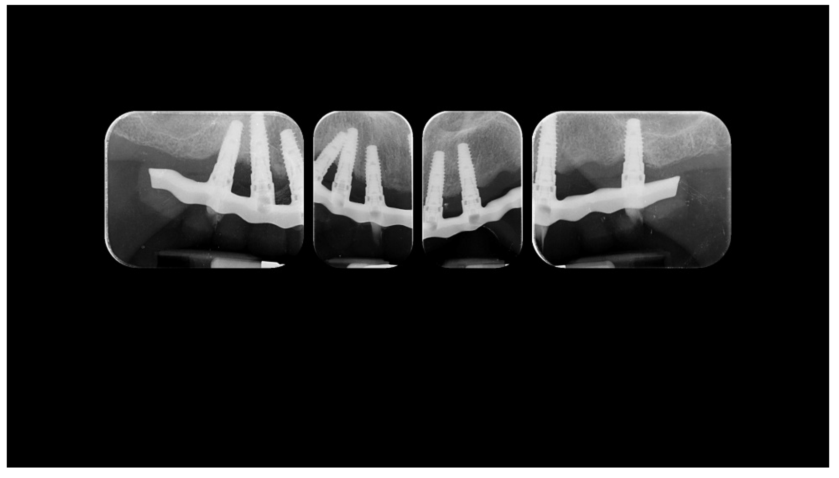 Materials 13 01883 g016 Materials 13 01883 g016