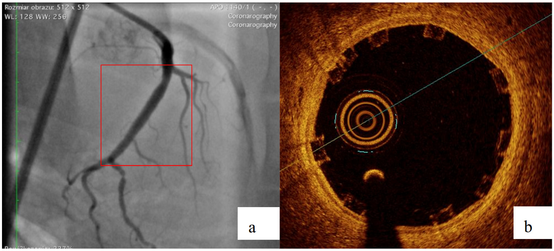 Materials 13 02003 g013a