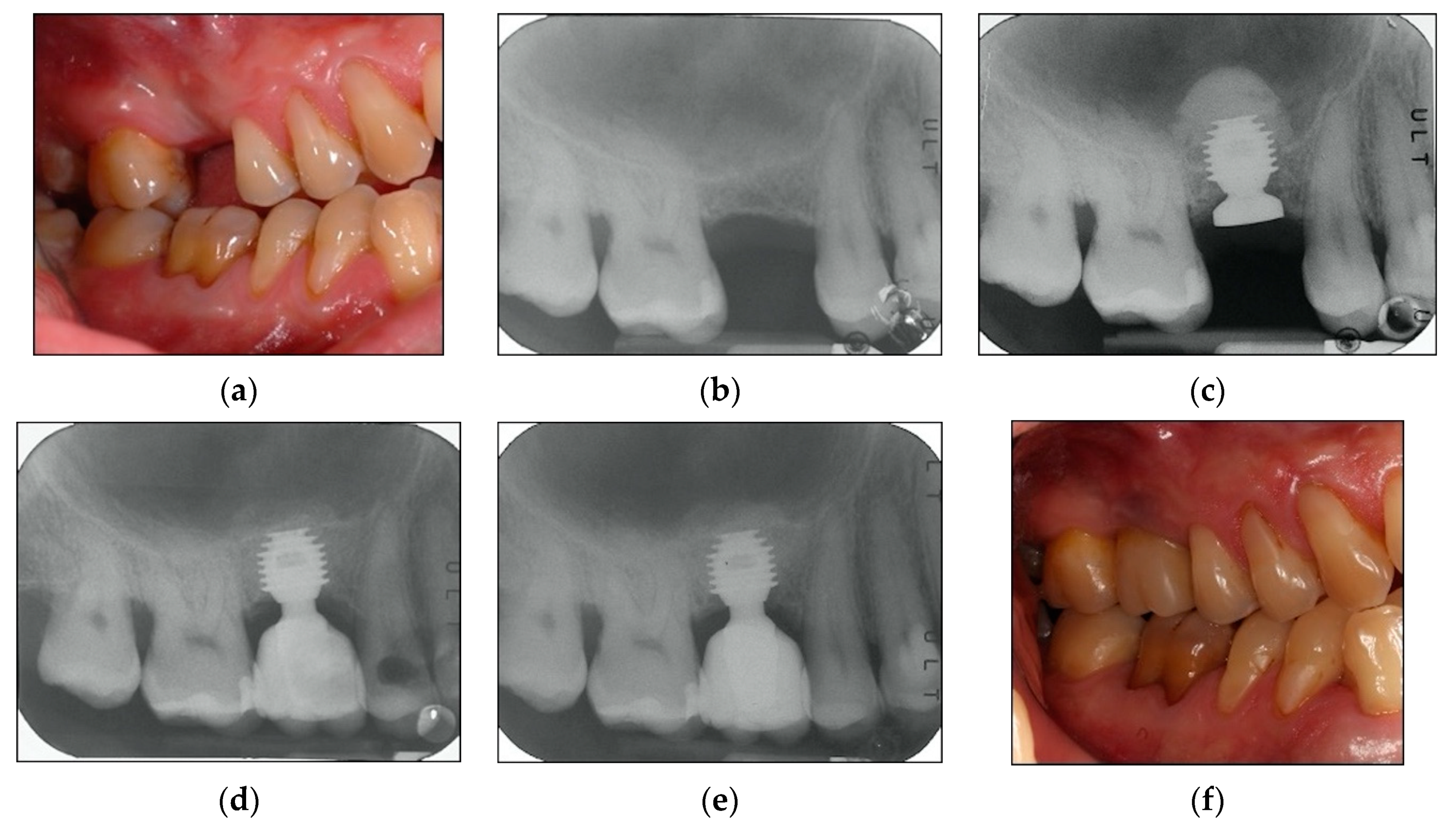 Materials 13 02208 g002 Materials 13 02208 g002