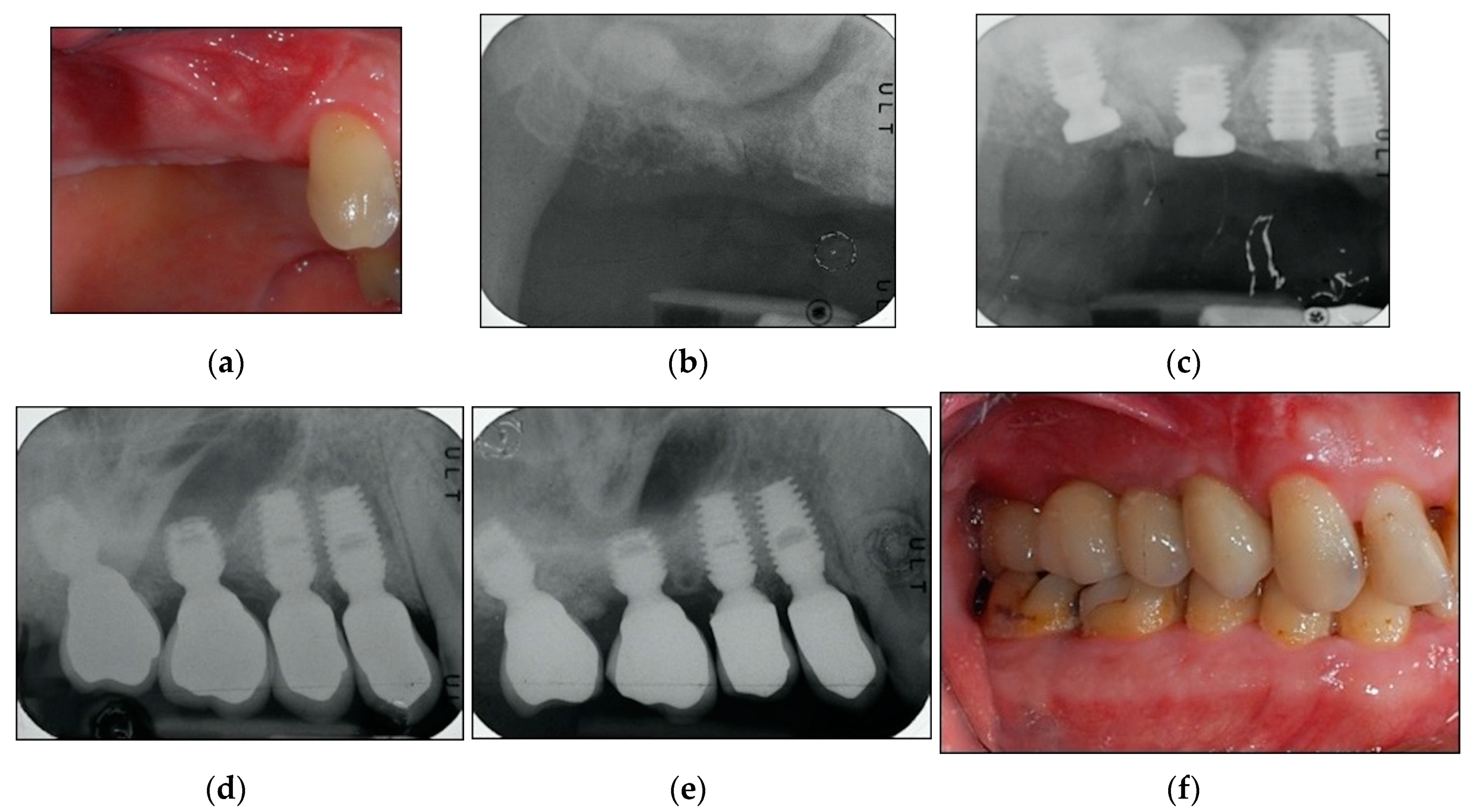Materials 13 02208 g003 Materials 13 02208 g003