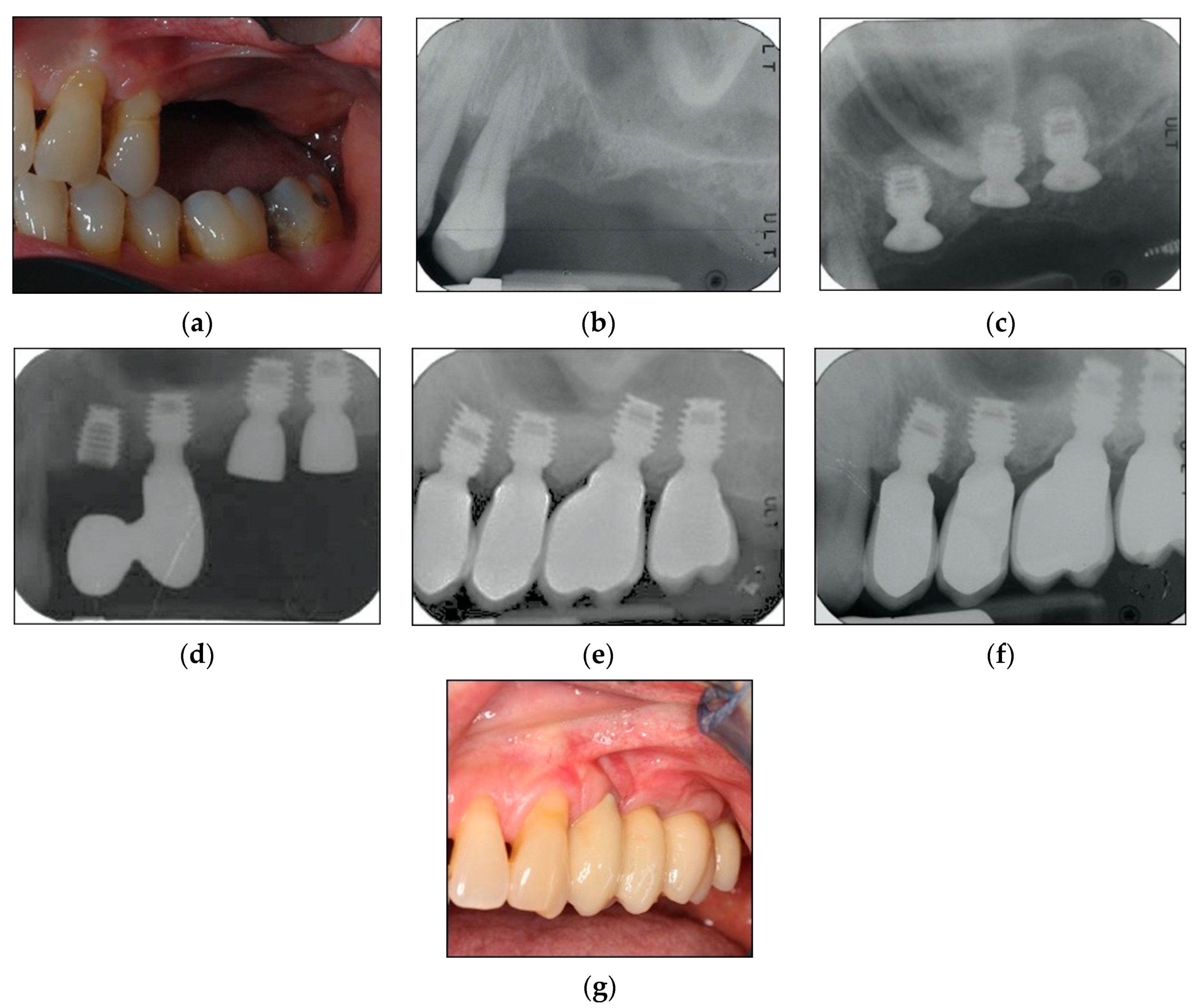 Materials 13 02208 g004 Materials 13 02208 g004